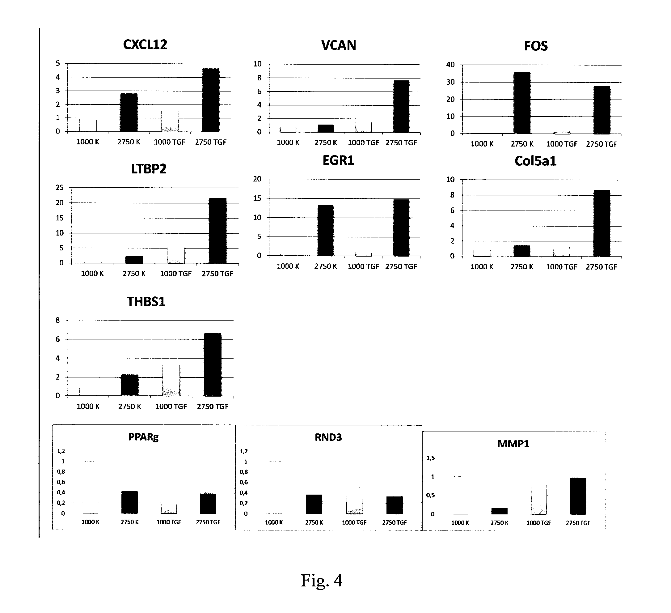 Cxcl12 (chemokine (c-x-c motif) ligand 12) and igfbp2 inhibitors for the application in the treatment of diabetes mellitus associated pancreatic cancer