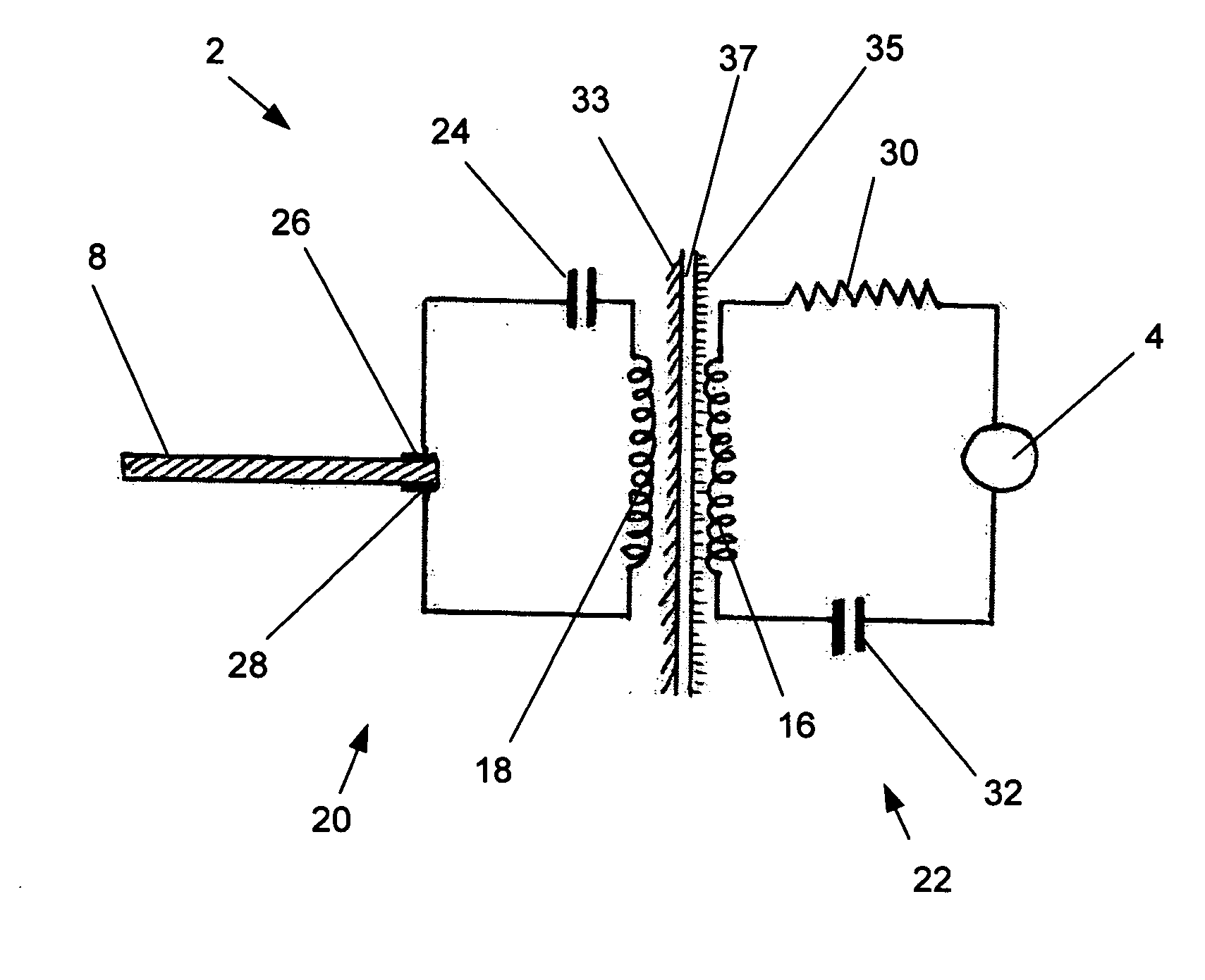 Airway implant and methods of making and using