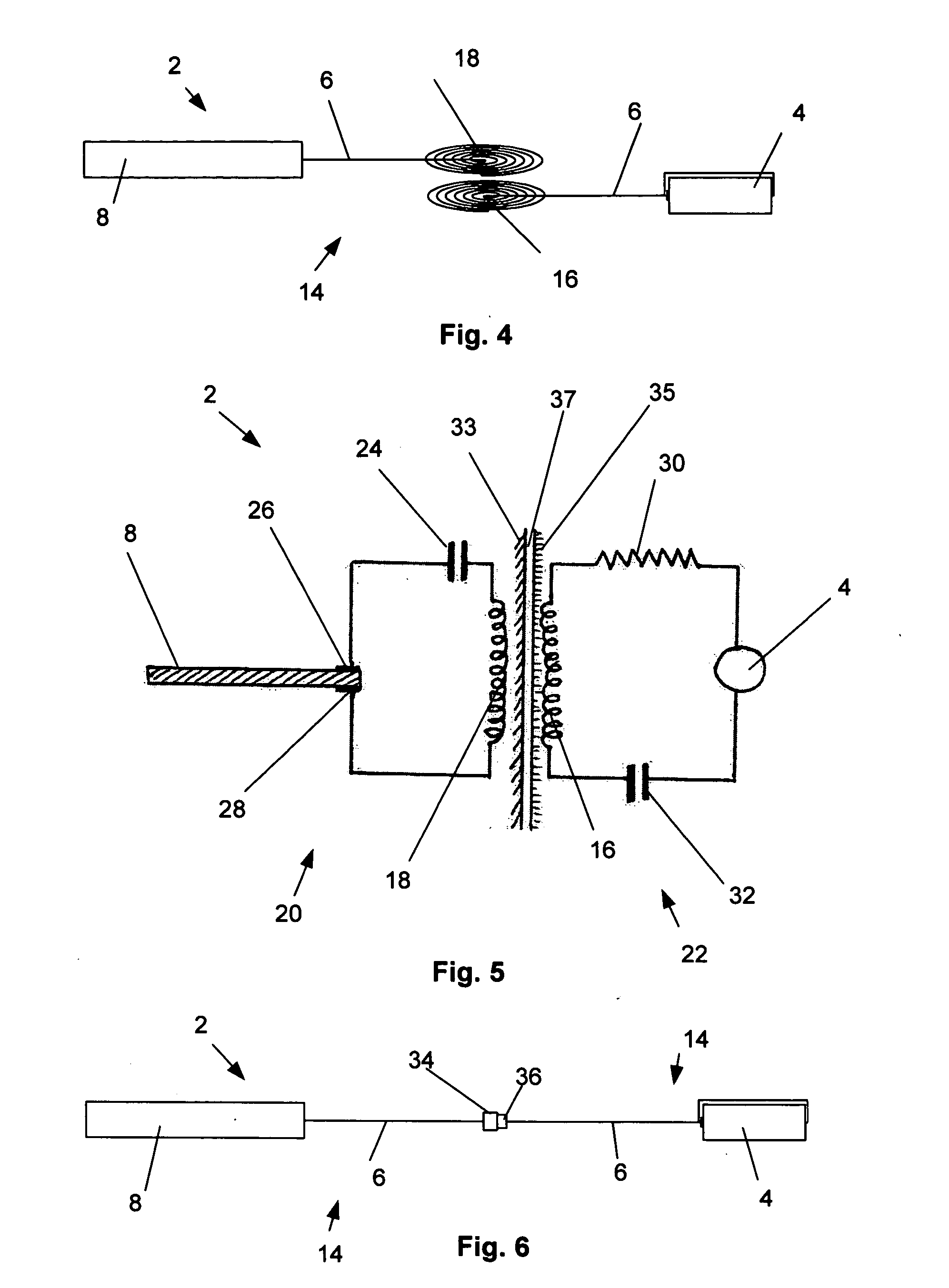 Airway implant and methods of making and using