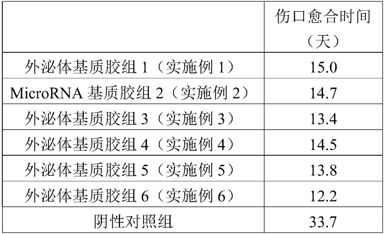 Preparation method of exosome as well as exosome prepared by adopting method and applications of exosome