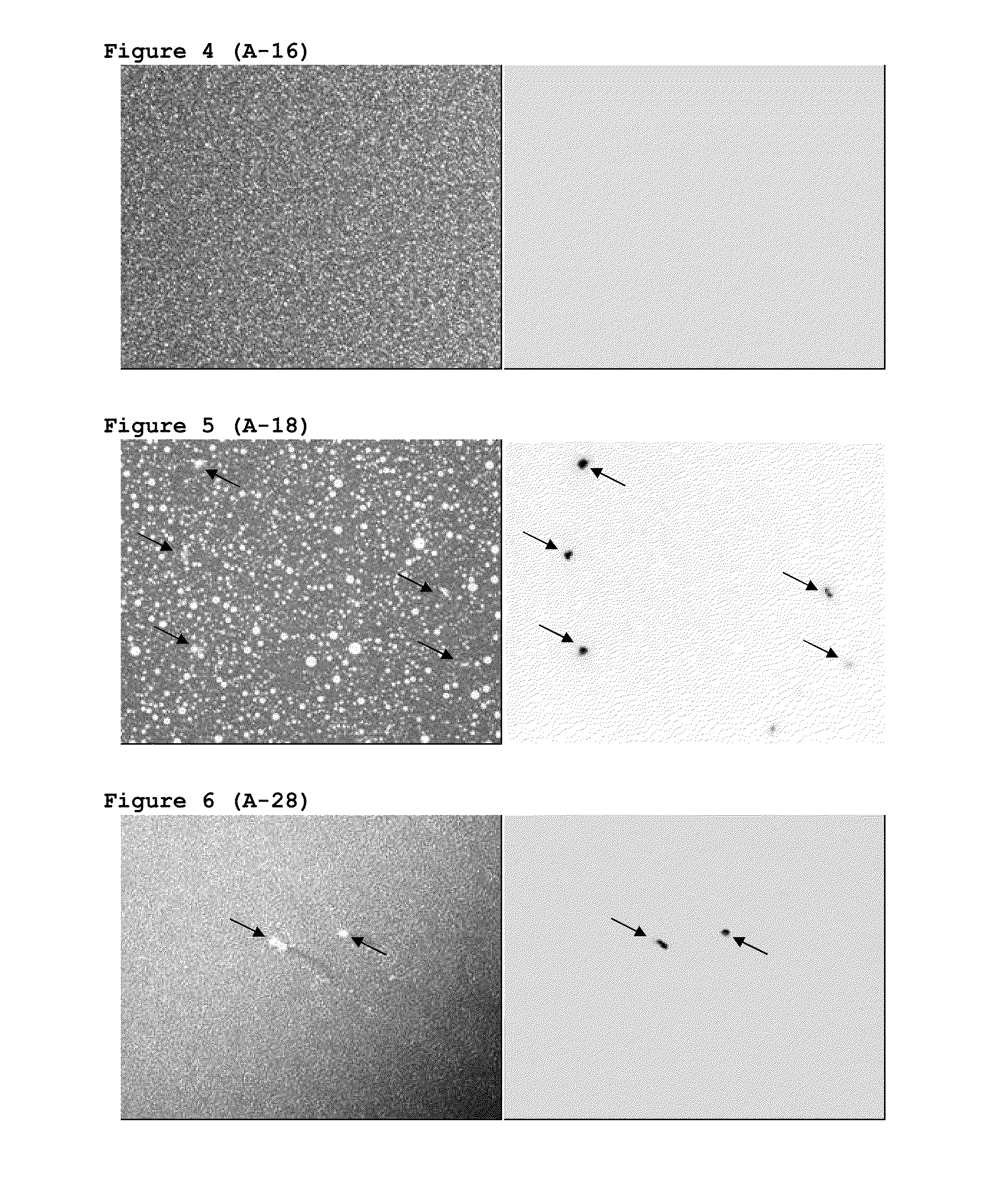 Pharmaceutical compositions comprising tgf-beta 1 inhibitor peptides