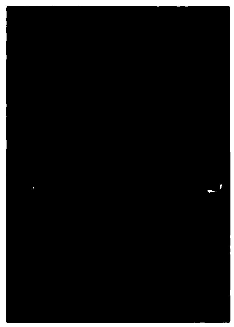 Preparation method of high-strength hydrogel