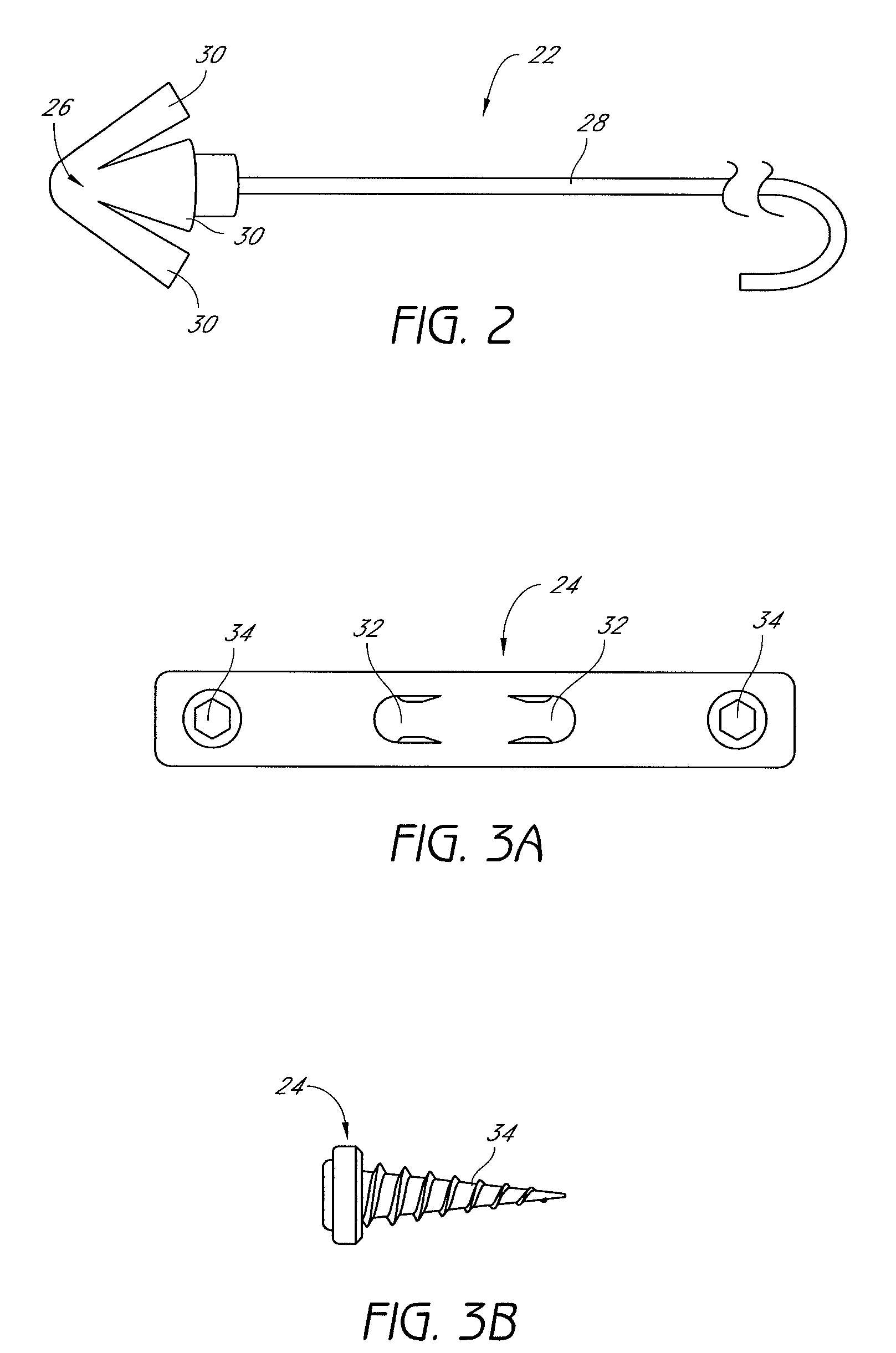 System and method for temporary tongue suspension