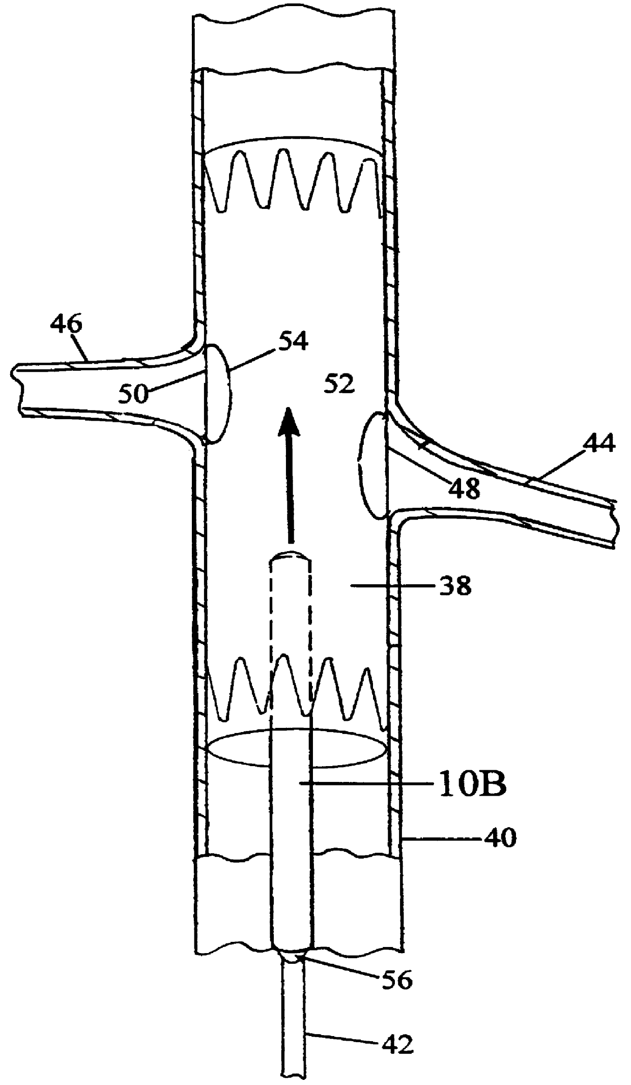 Mated main and collateral stent and method for treatment of arterial disease