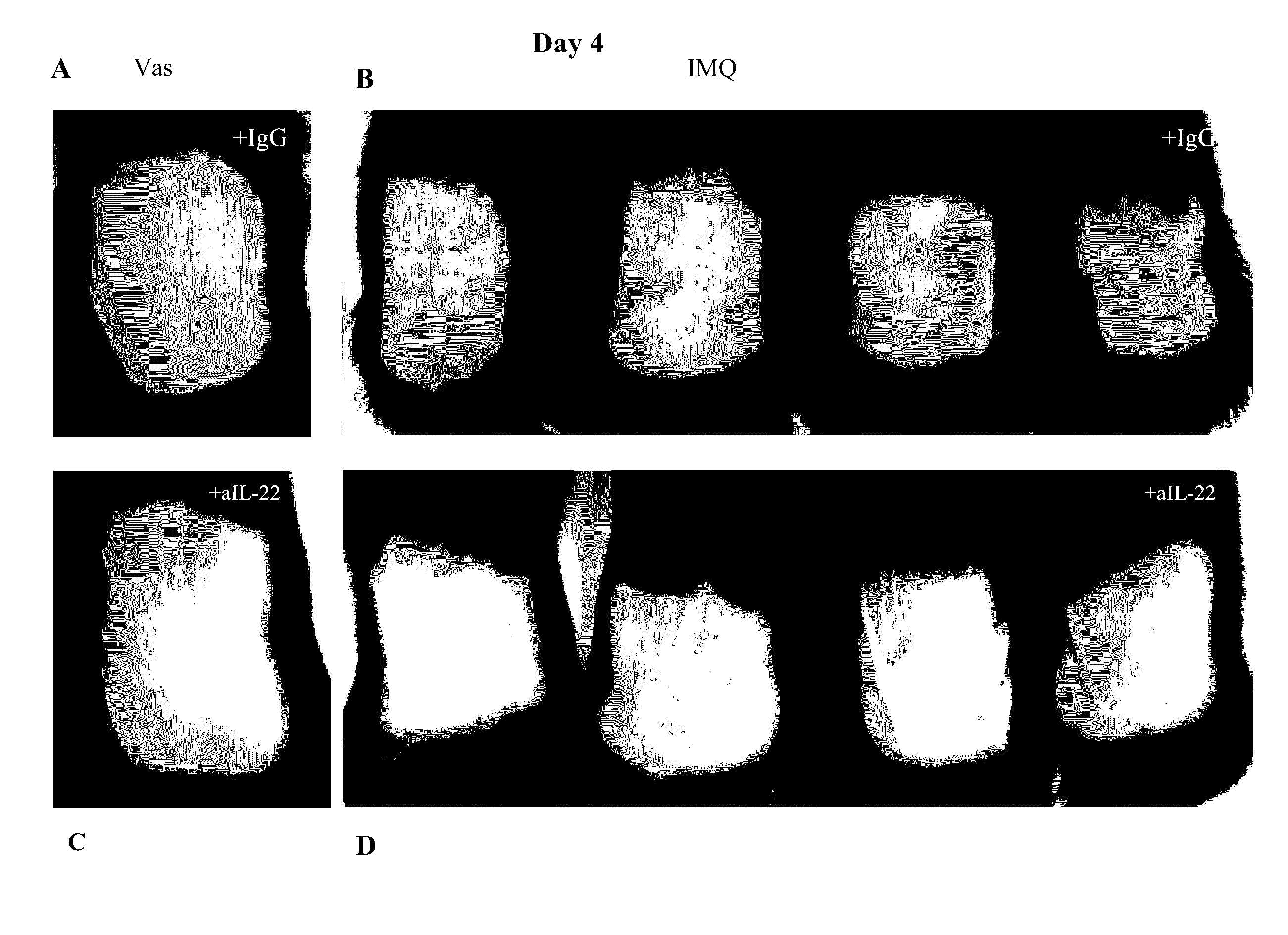 Method of providing monoclonal auto-antibodies with desired specificity