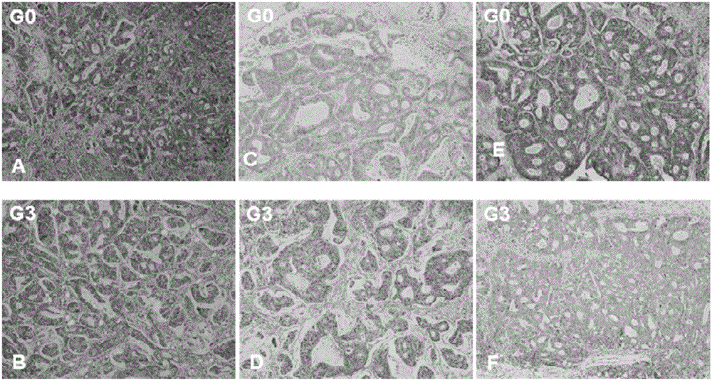 Method for cryopreserving tumor tissue