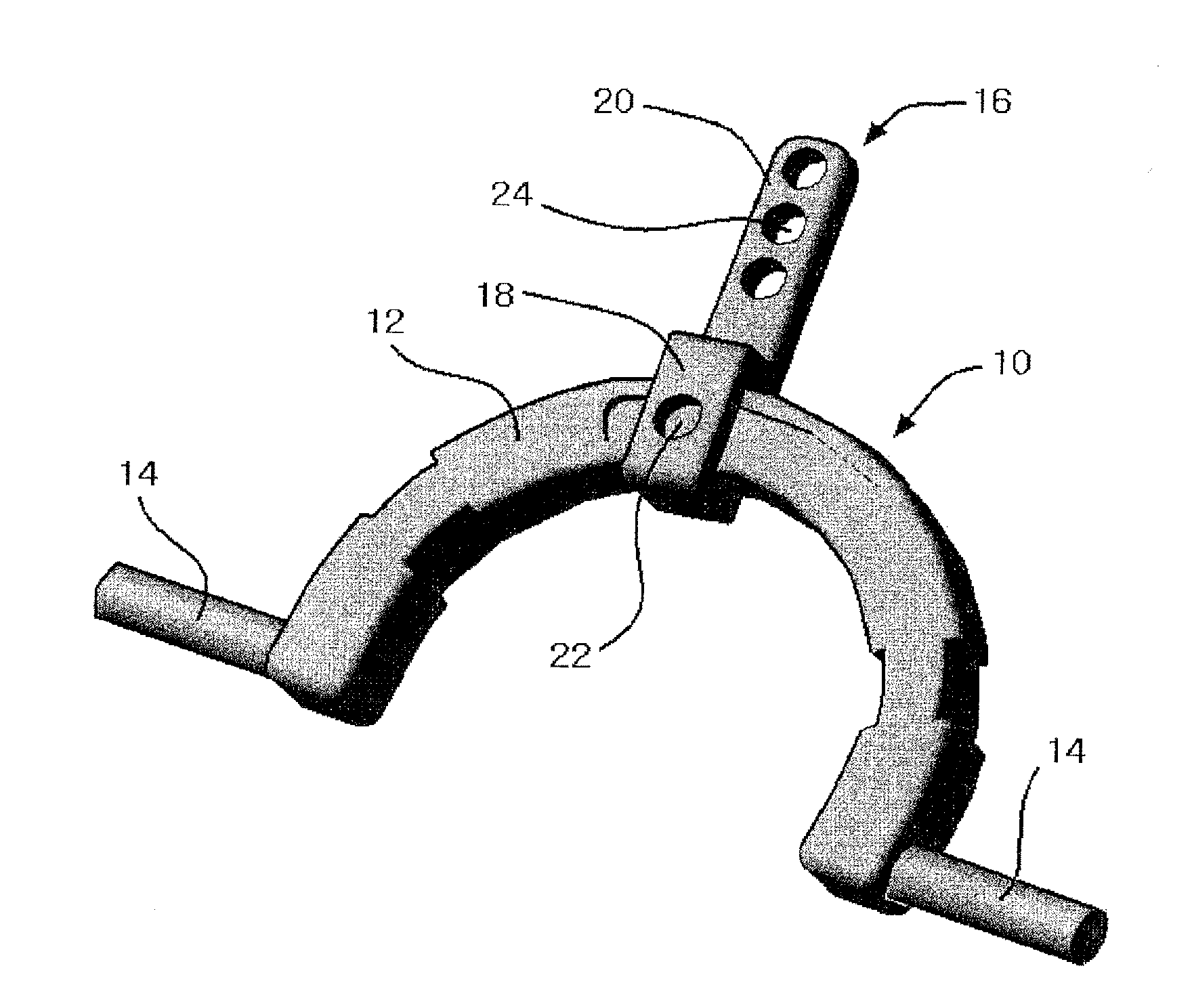 Apparatus for Occipital-Cervical Fixation Enabling Supplemental Occipital Bone Fixation