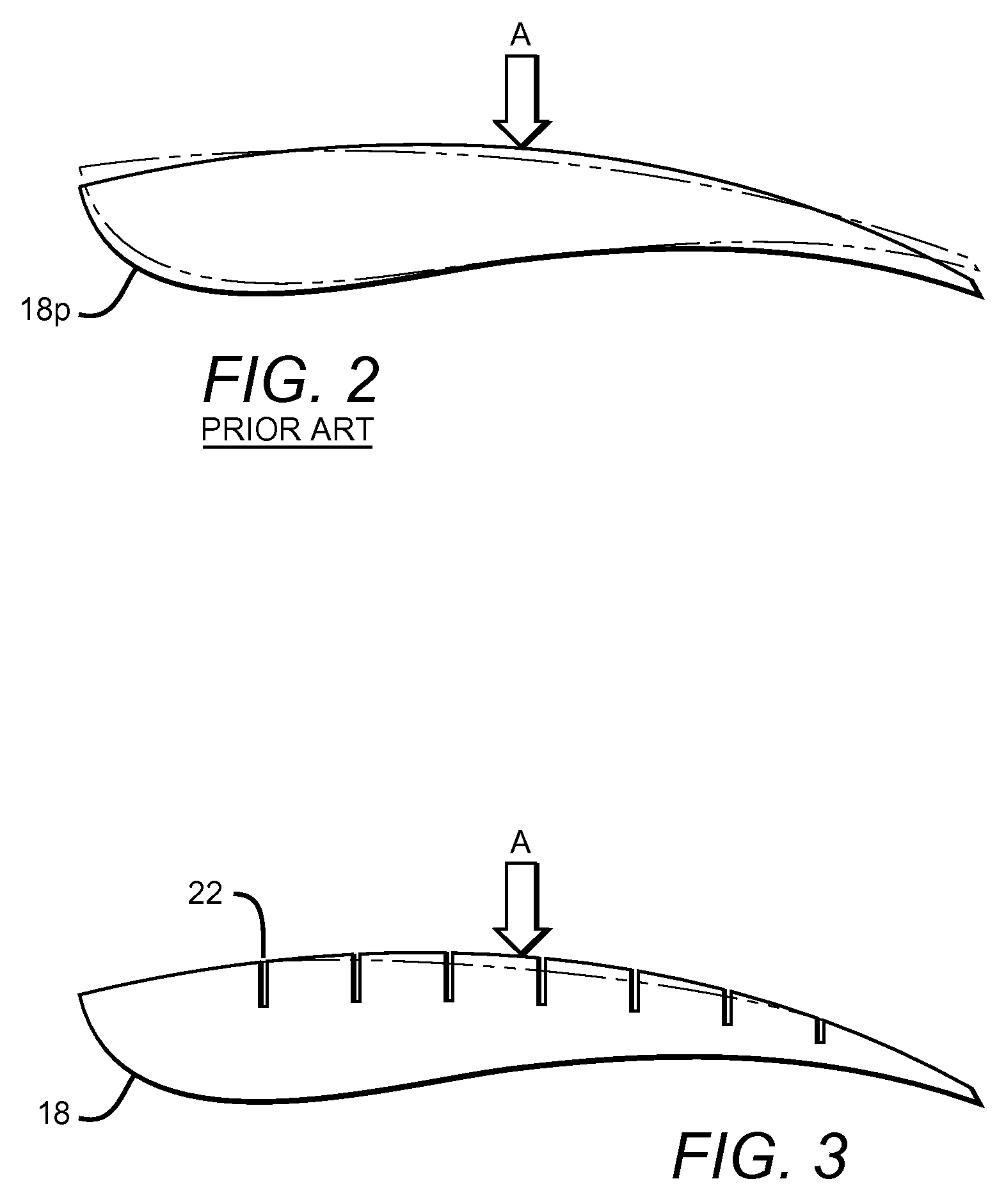 Improved orthotic shell for orthopedic sole insert