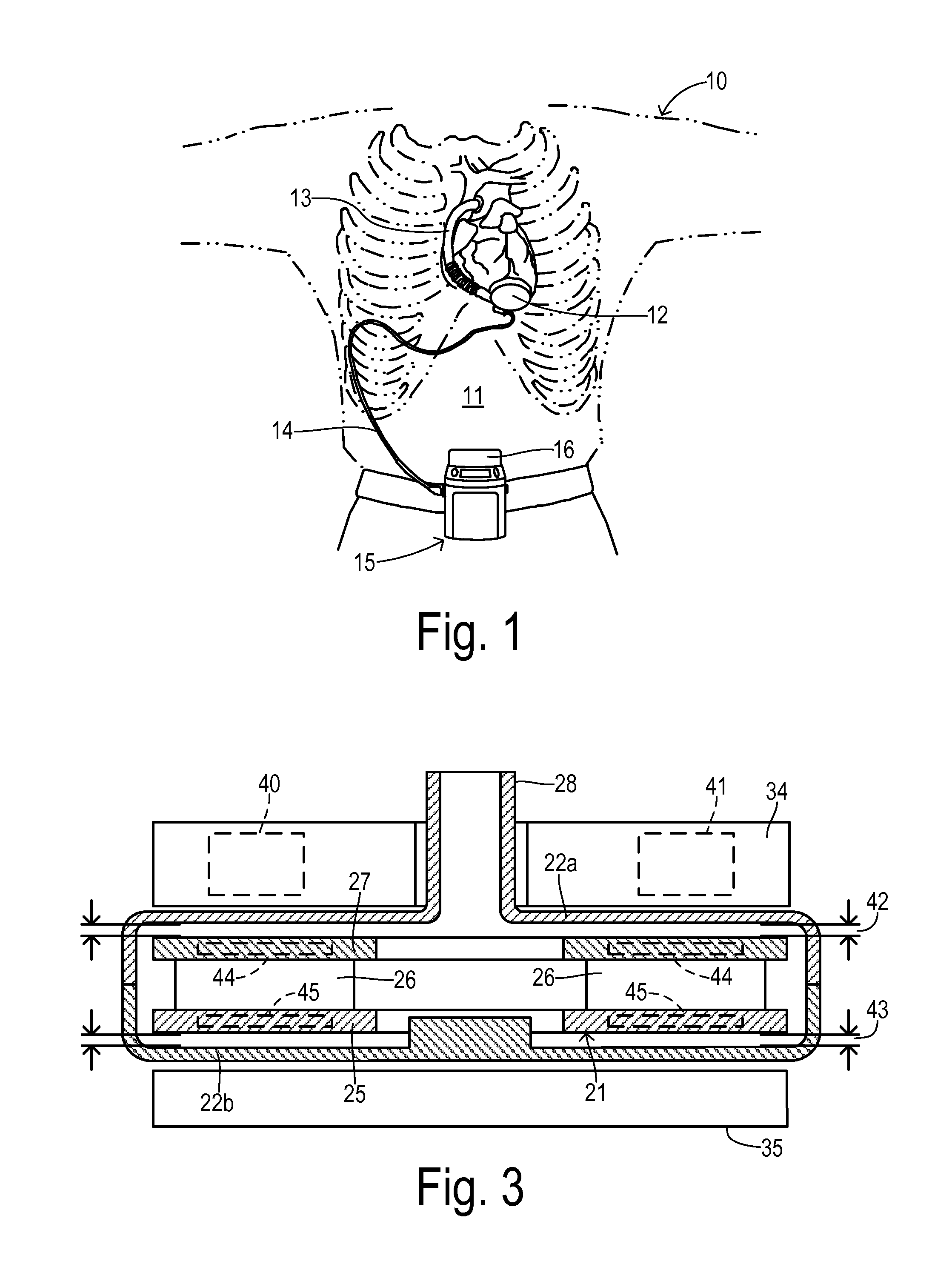 Startup sequence for centrifugal pump with levitated impeller