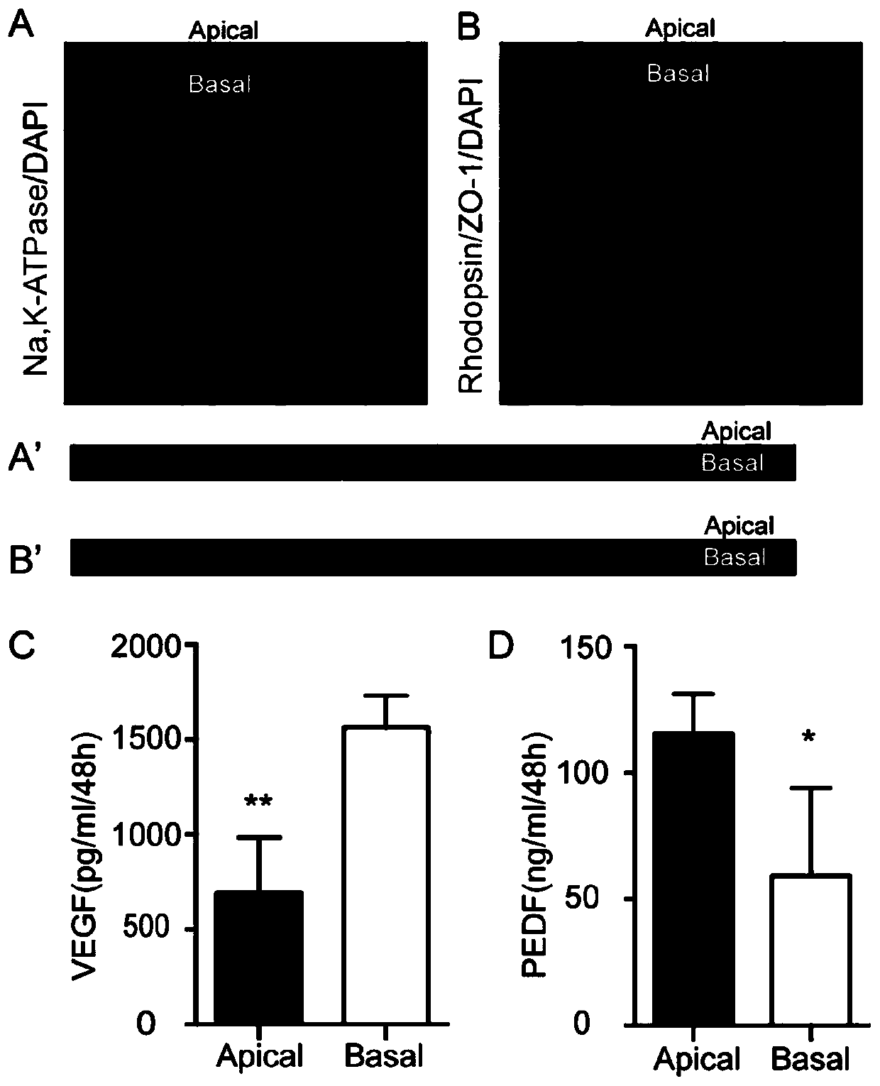 Method for inducing differentiation of human amniotic epithelial cells into retinal pigment epithelial cells, and applications thereof