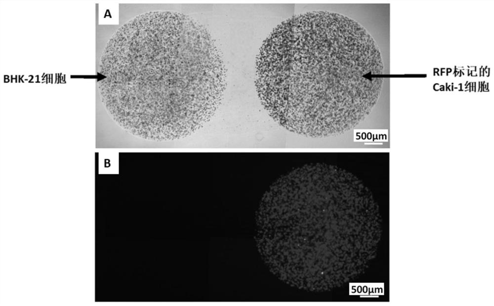 3D co-culture model of fibroblasts and cancer cells as well as preparation method and application of model