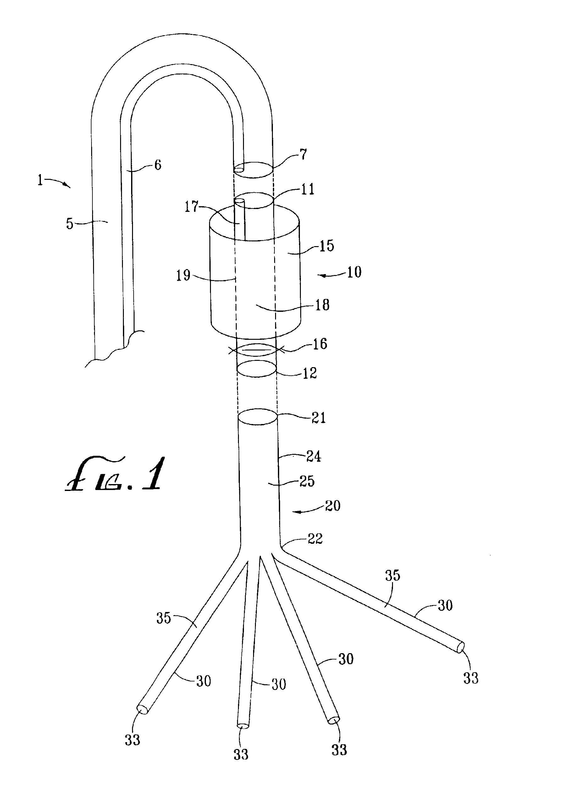 Aortic shunt with spinal perfusion and cooling device