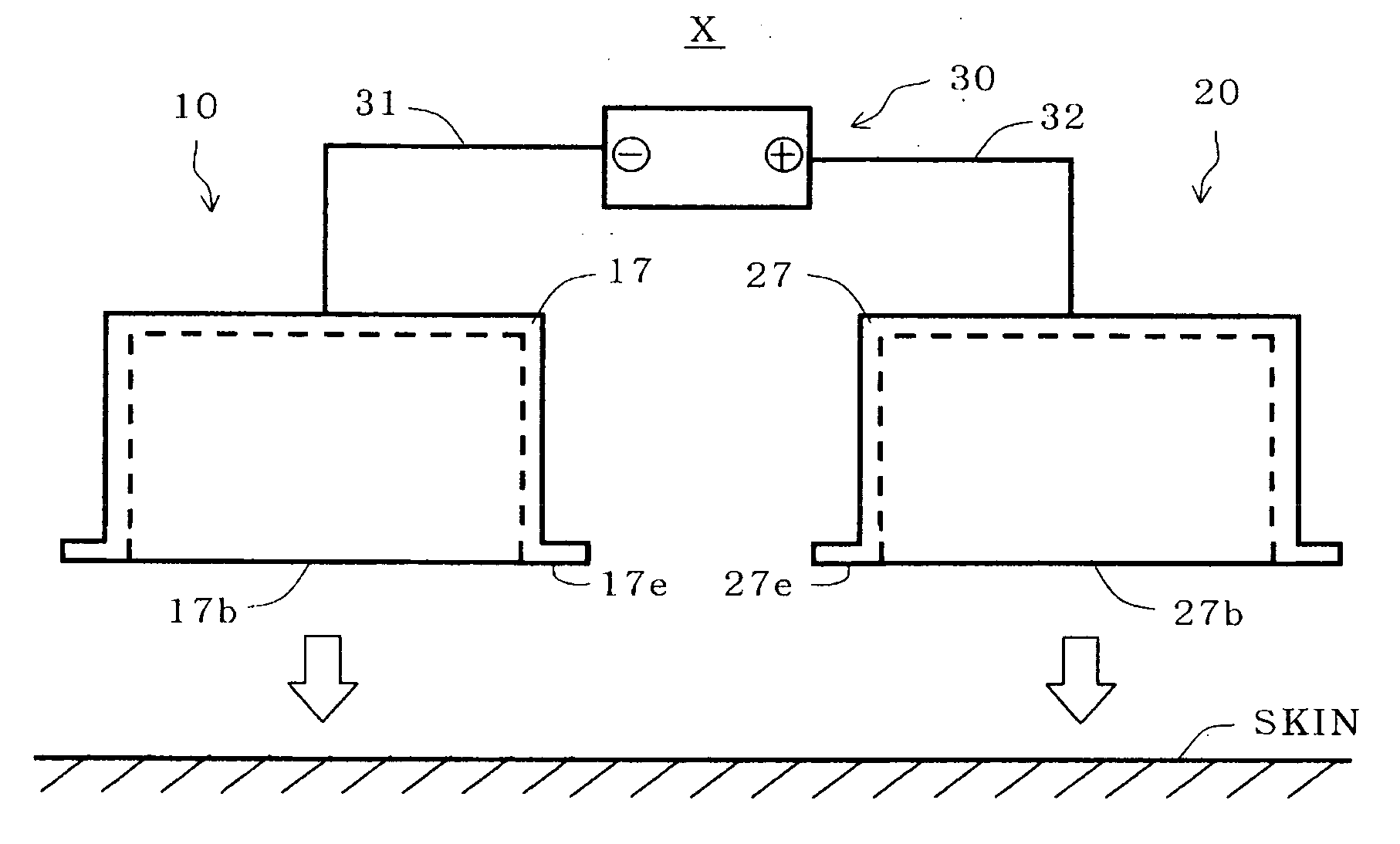 Iontophoresis device