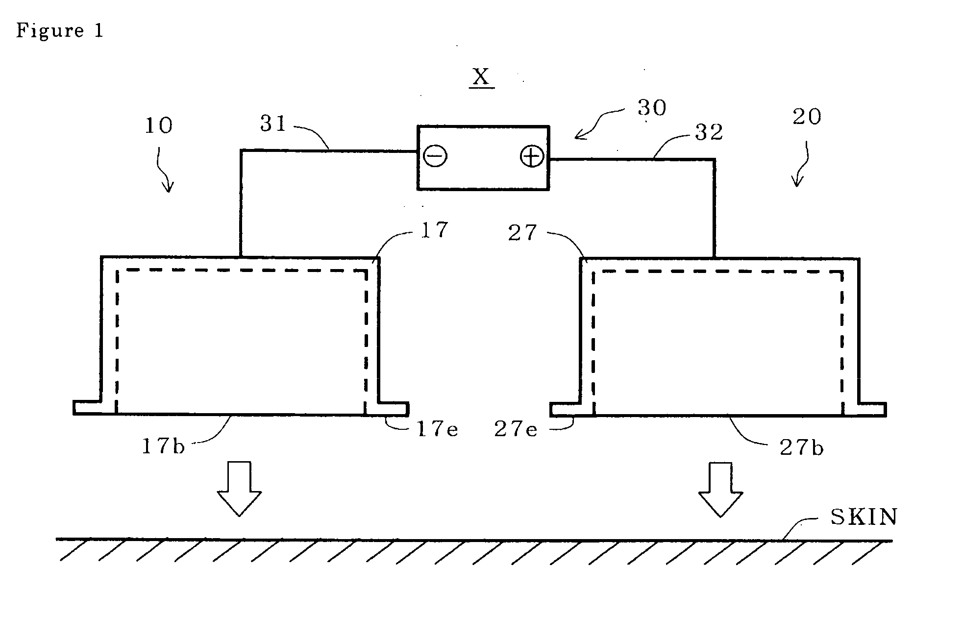 Iontophoresis device