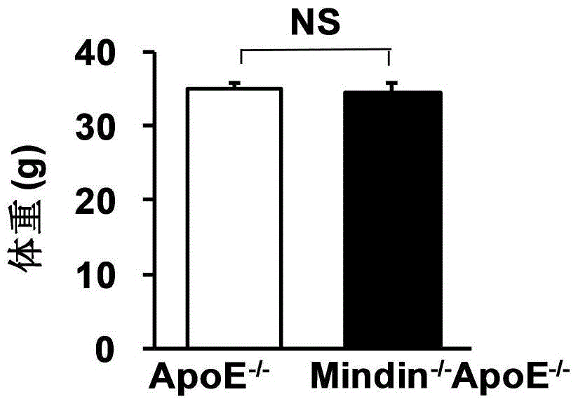 Application of mindin gene in the treatment of atherosclerosis