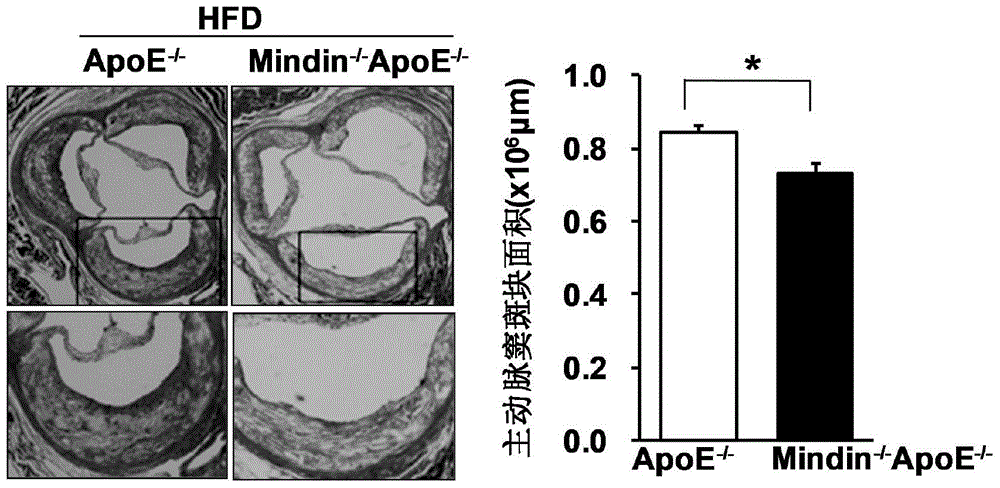 Application of mindin gene in the treatment of atherosclerosis