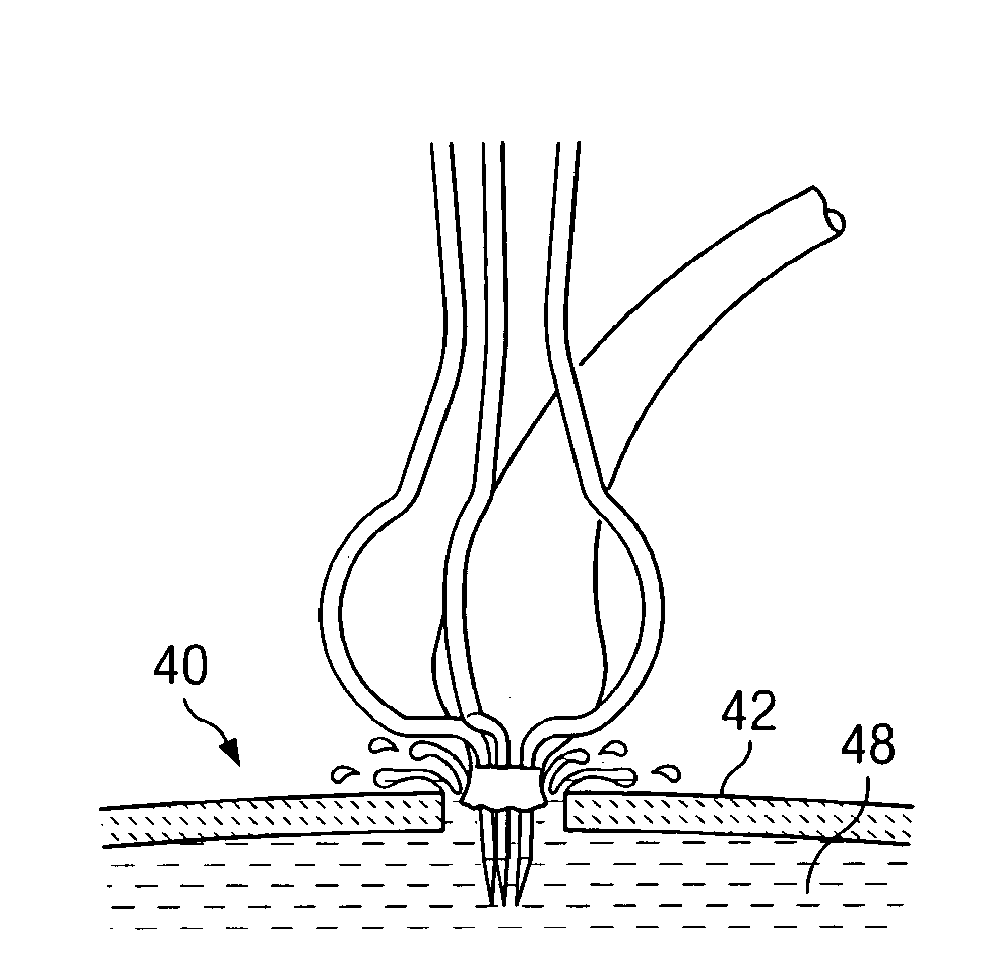 System and method for attaching a vein, an artery, or a tube in a vascular environment