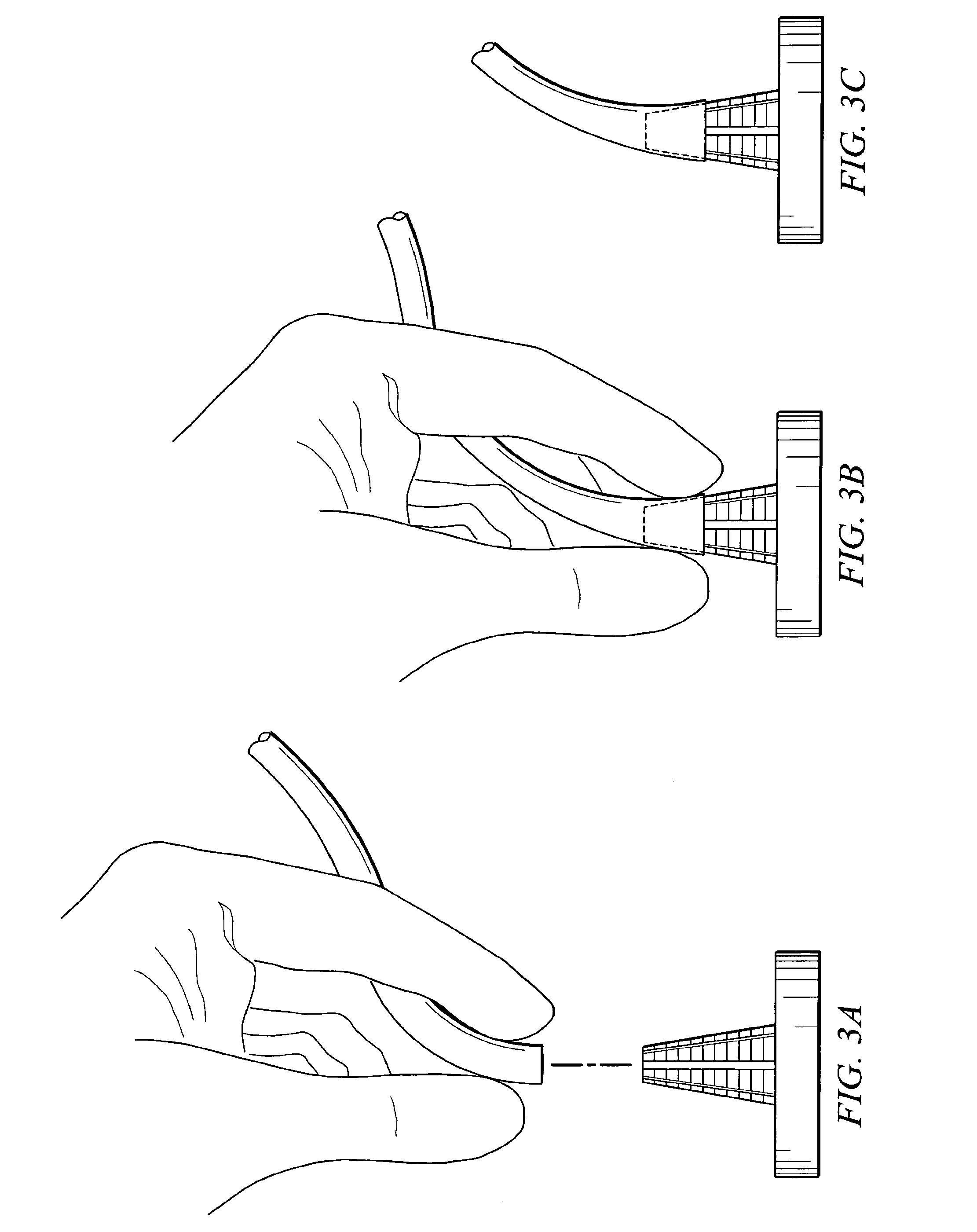 System and method for attaching a vein, an artery, or a tube in a vascular environment