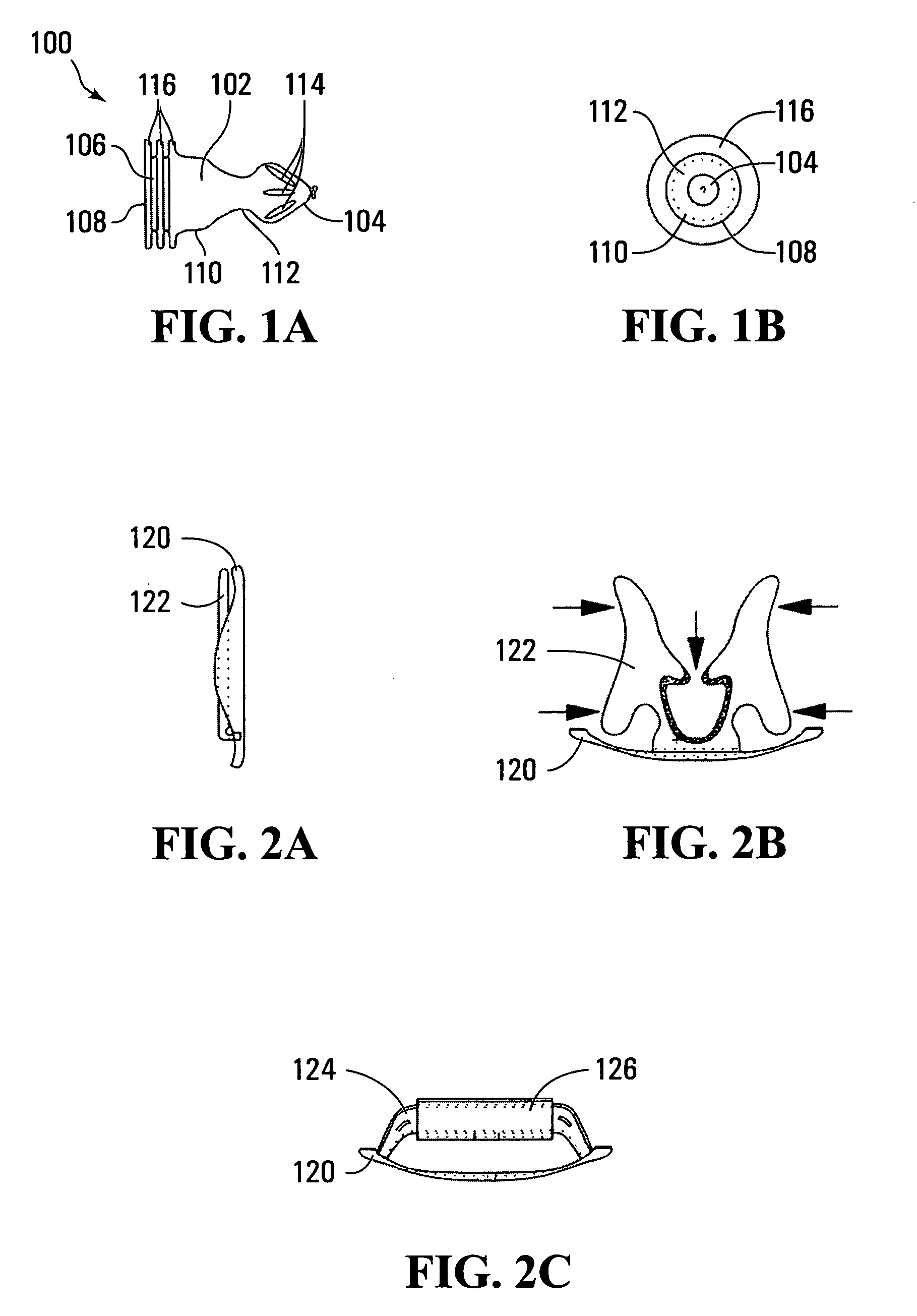 External penile prosthesis, combination of prosthesis and loose-fitting condom, and method of using condom