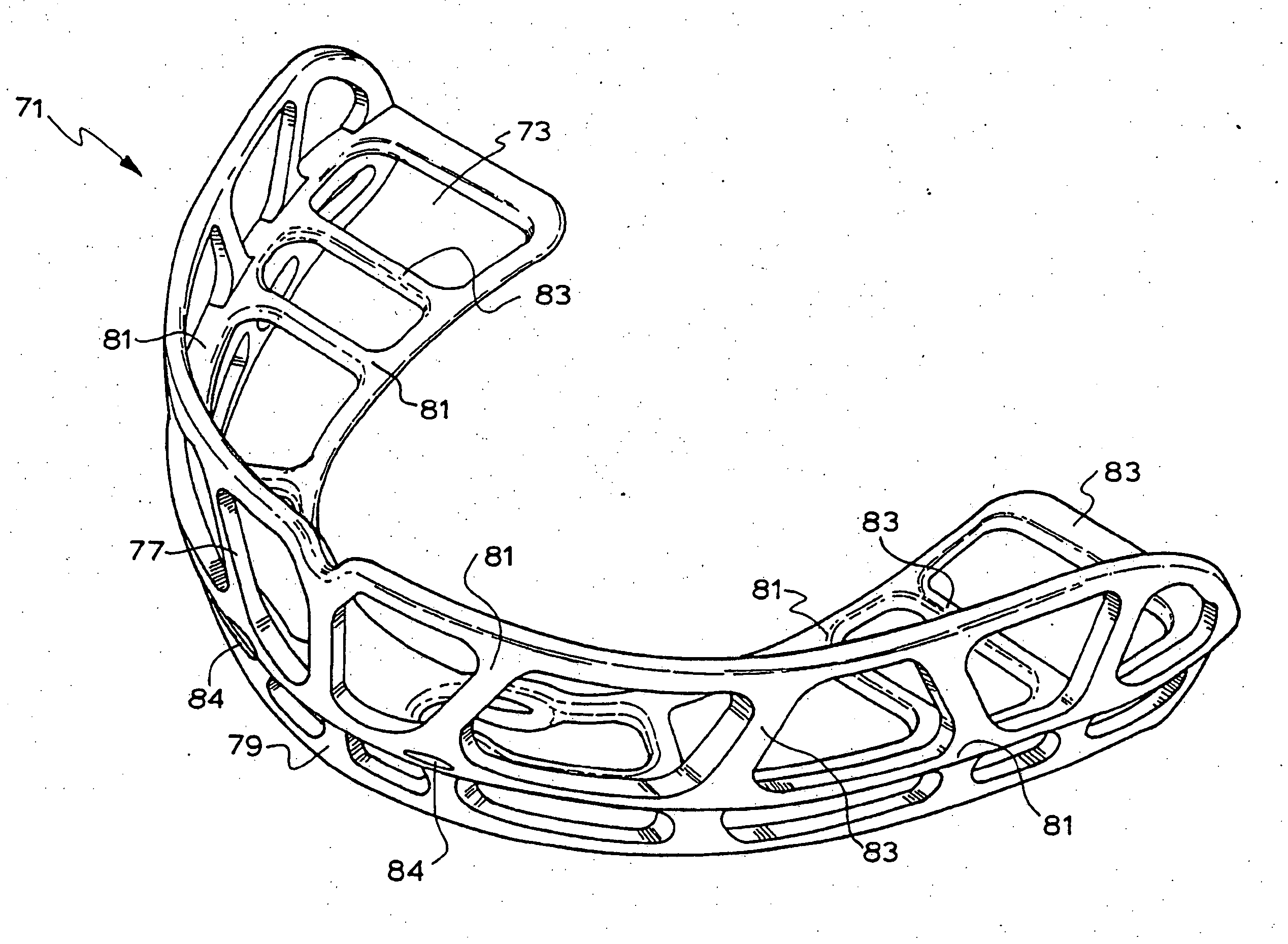 Orthodontic appliance