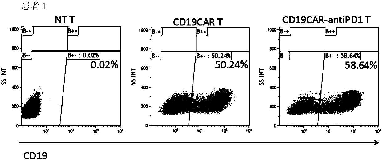 CAR-T cell specifically targeting CD19 antigen and stably expressing PD-1 antibodies at high levels as well as application of CAR-T cell