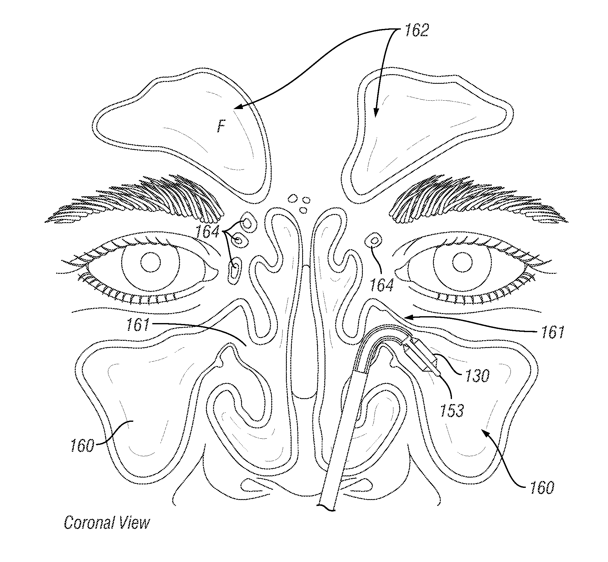 Methods for Providing Therapy to an Anatomical Structure