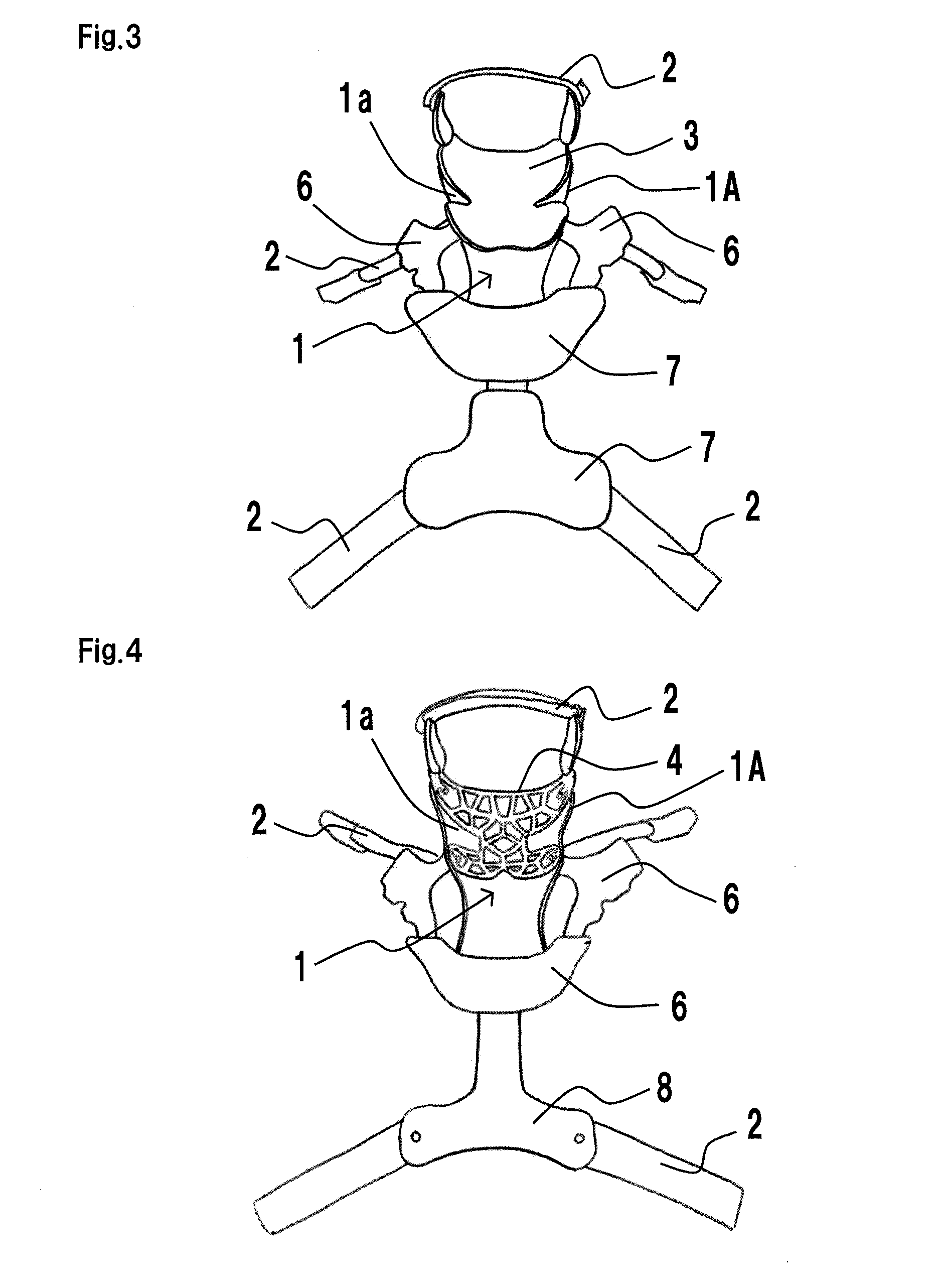 Cervical orthosis