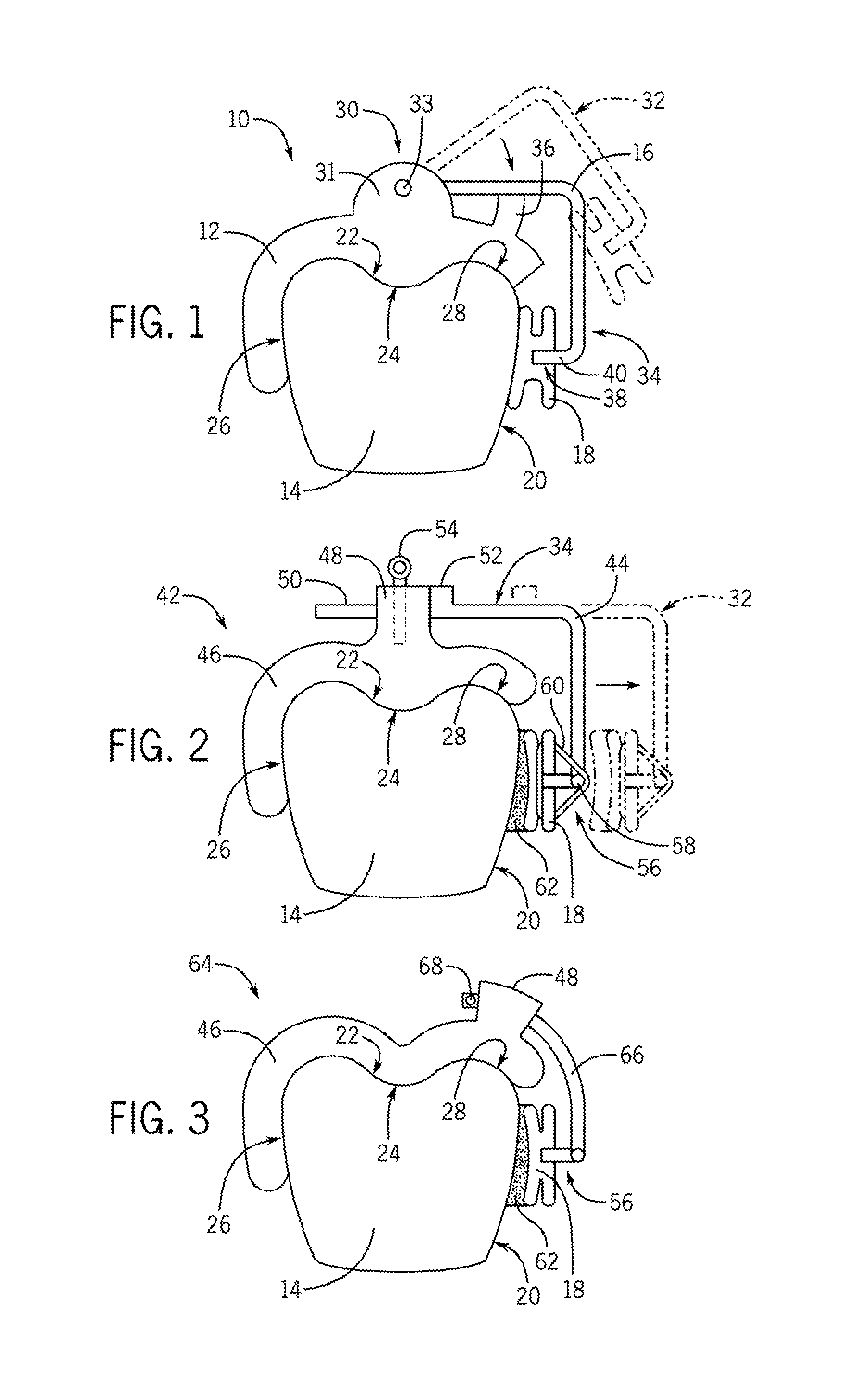 Indirect Bonding Tray and Method of Manufacture Thereof