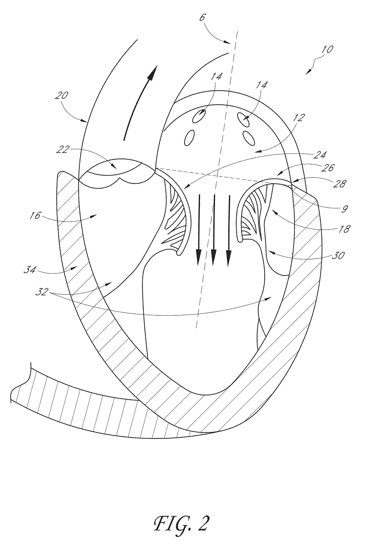 Percutaneous delivery systems for anchoring an implant in a cardiac valve annulus