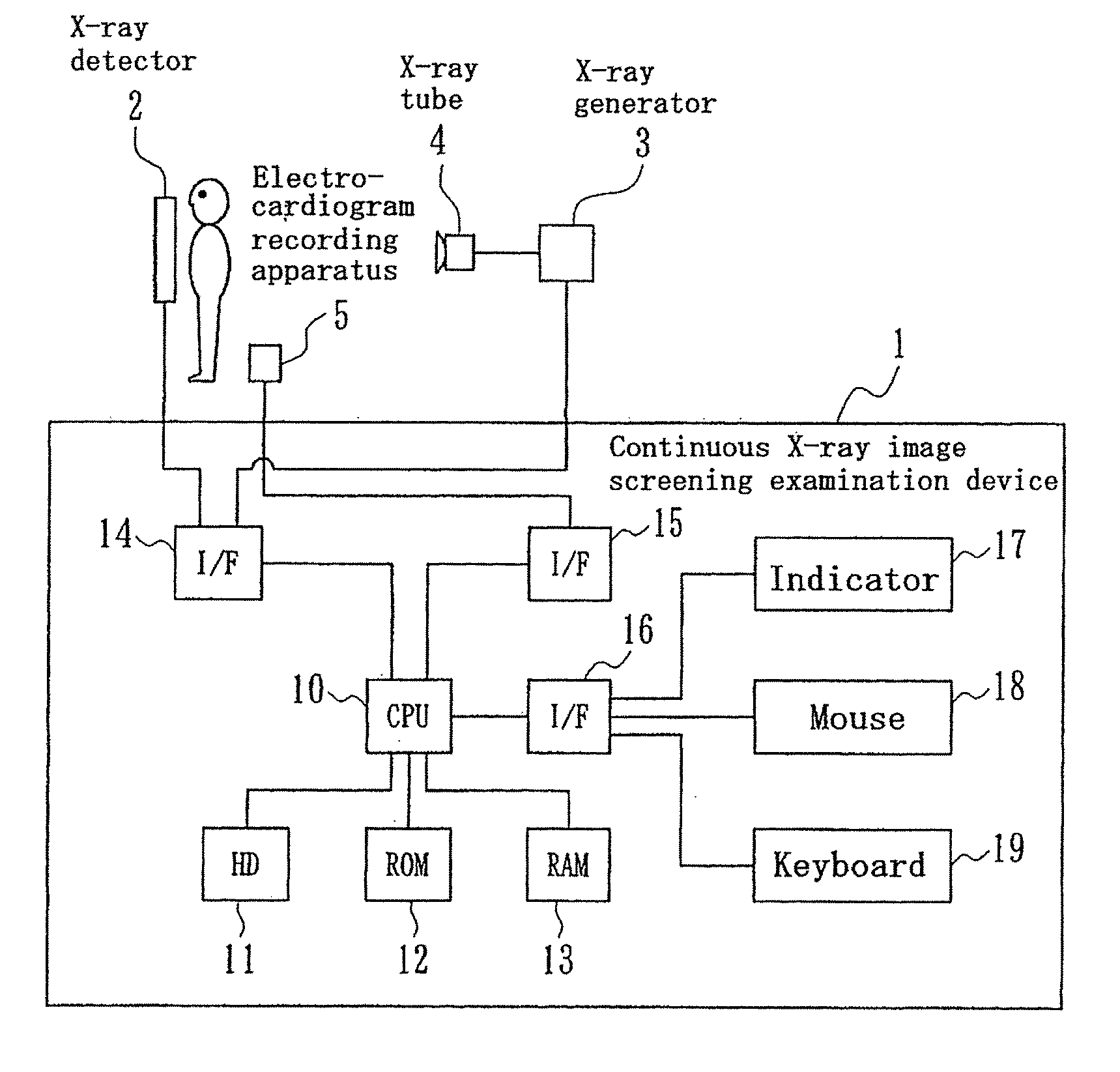 Continuous x-ray image screening examination device, program, and recording medium