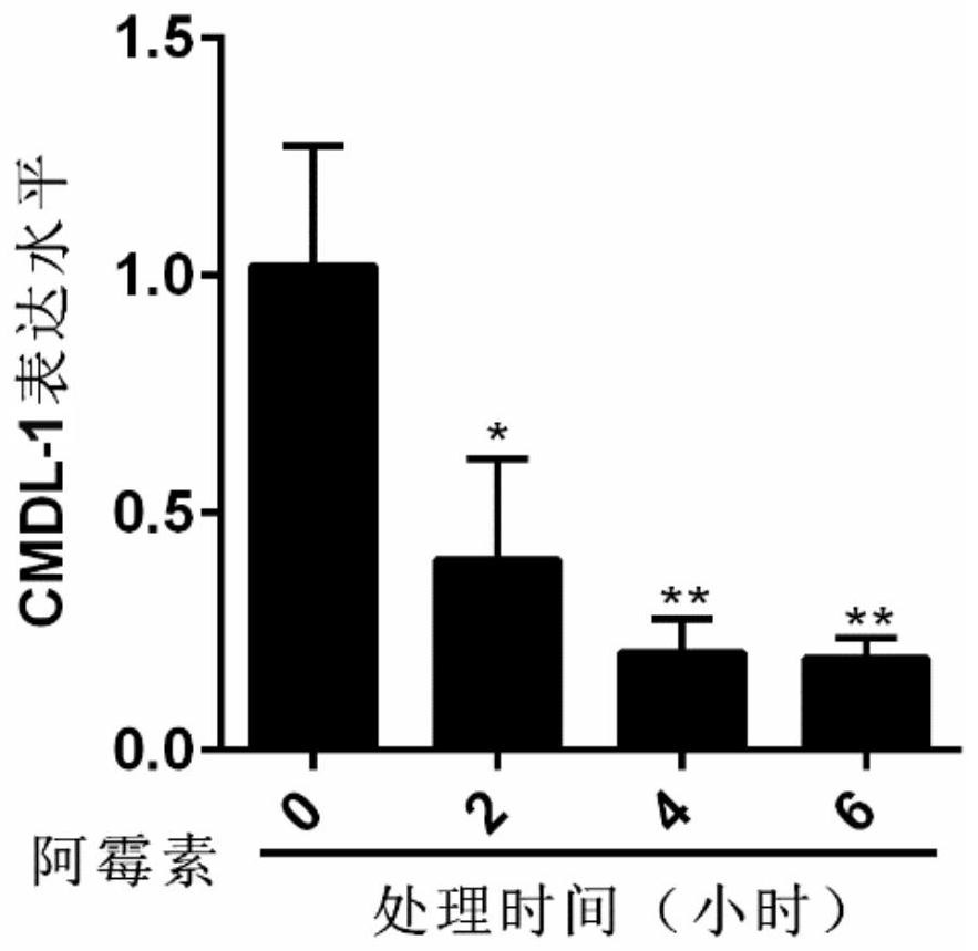 Application of cmdl-1, kit for diagnosing heart disease and drug for treating heart disease