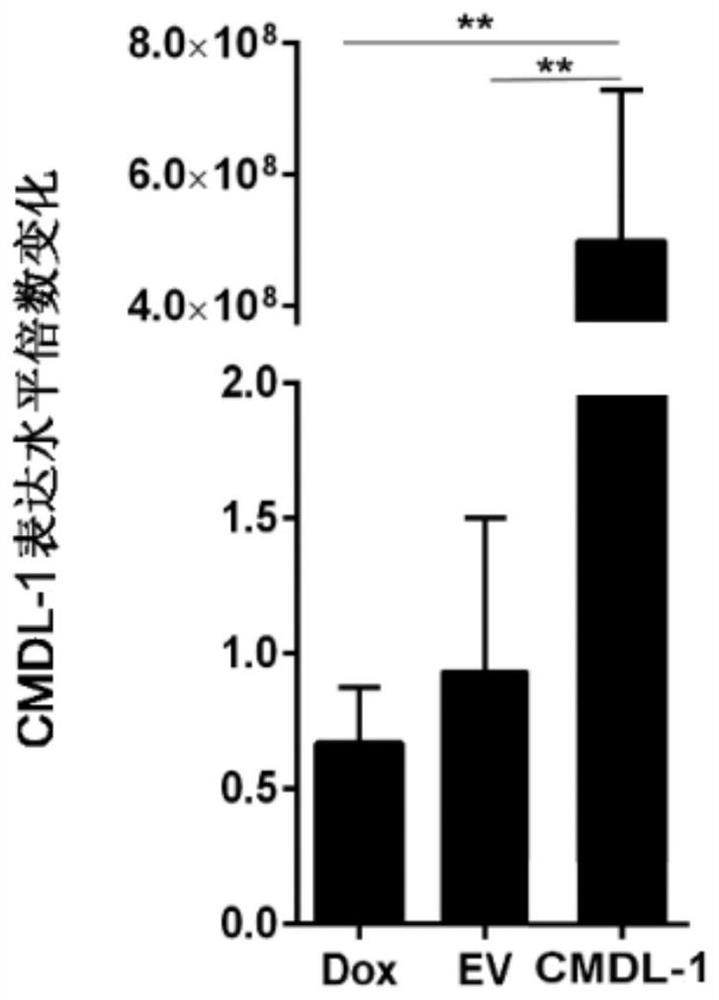 Application of cmdl-1, kit for diagnosing heart disease and drug for treating heart disease