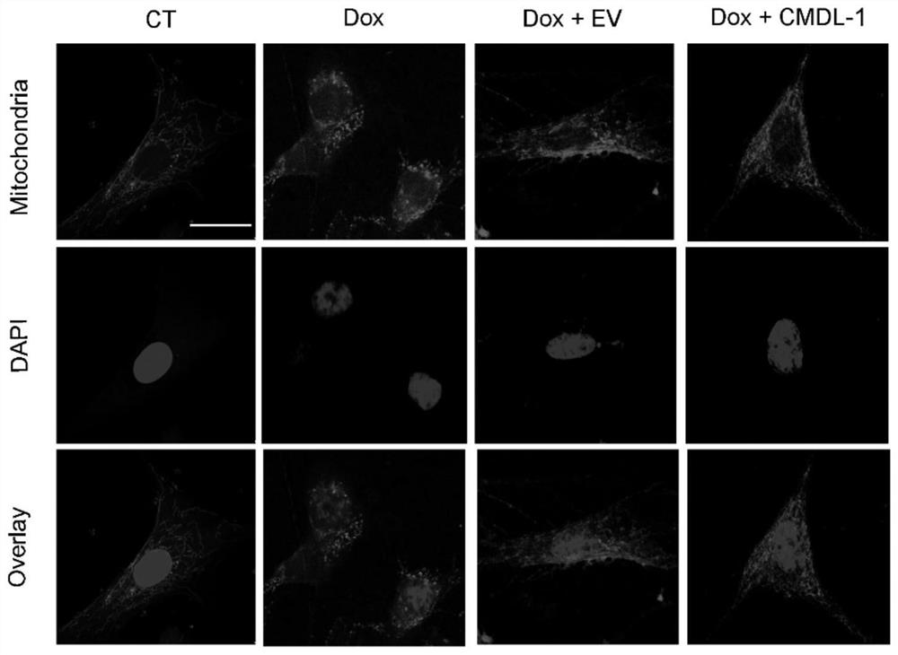 Application of cmdl-1, kit for diagnosing heart disease and drug for treating heart disease