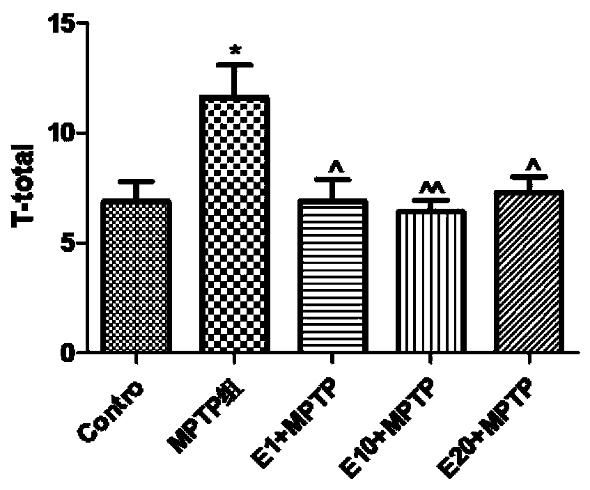 Application of epimedin B in preparation of medicine for treating dopaminergic neuron damage