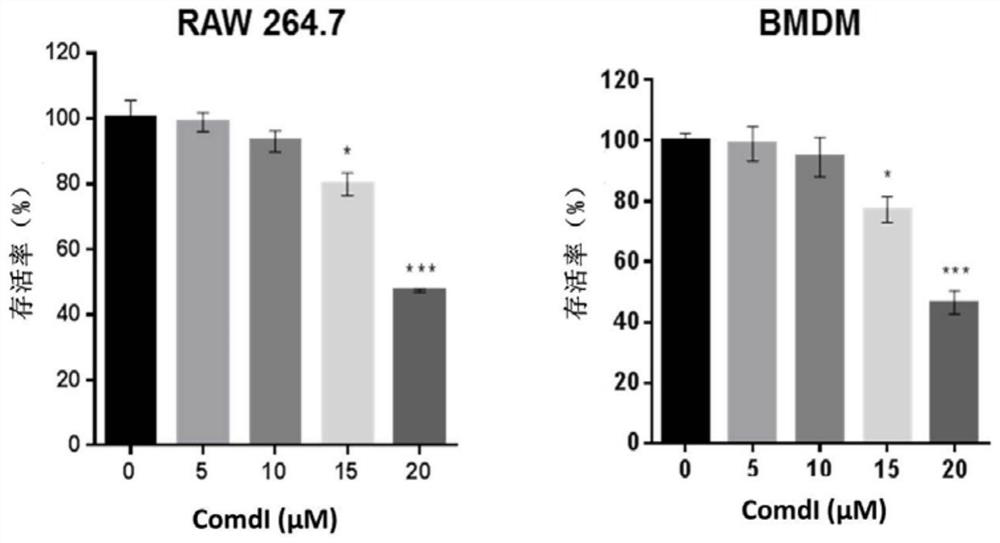 Application of SMS2 inhibitor in preparation of medicine for treating highly invasive breast cancer