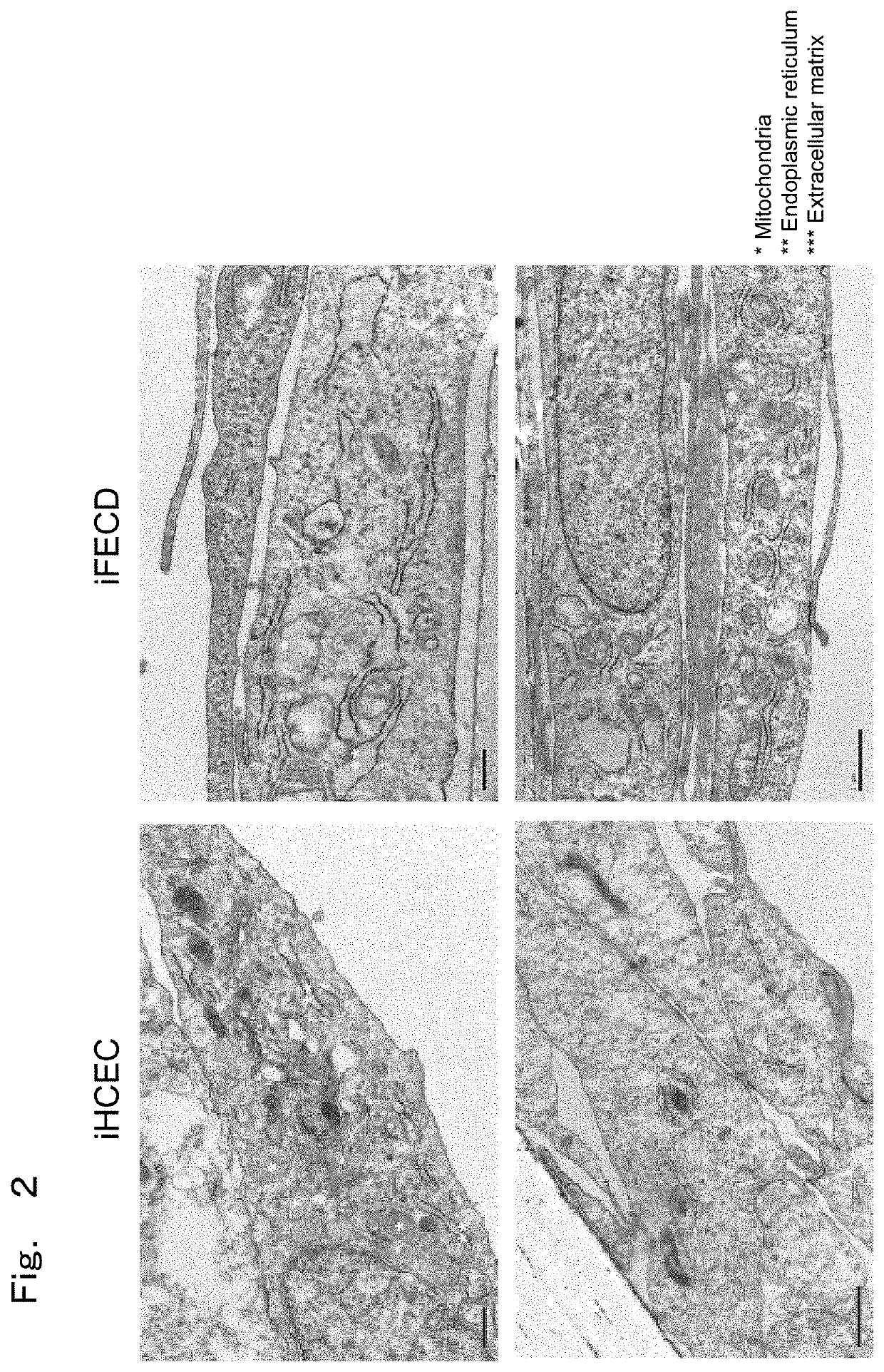 Therapeutic drug for diseases related to endoplasmic reticulum cell death in corneal endothelium