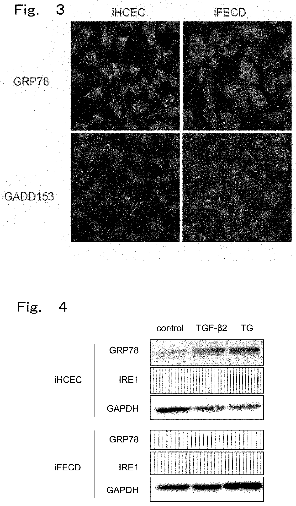 Therapeutic drug for diseases related to endoplasmic reticulum cell death in corneal endothelium