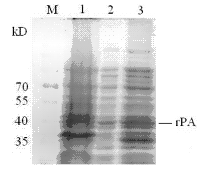 Method for expressing Reteplase in Escherichia coli by using dual plasmid system