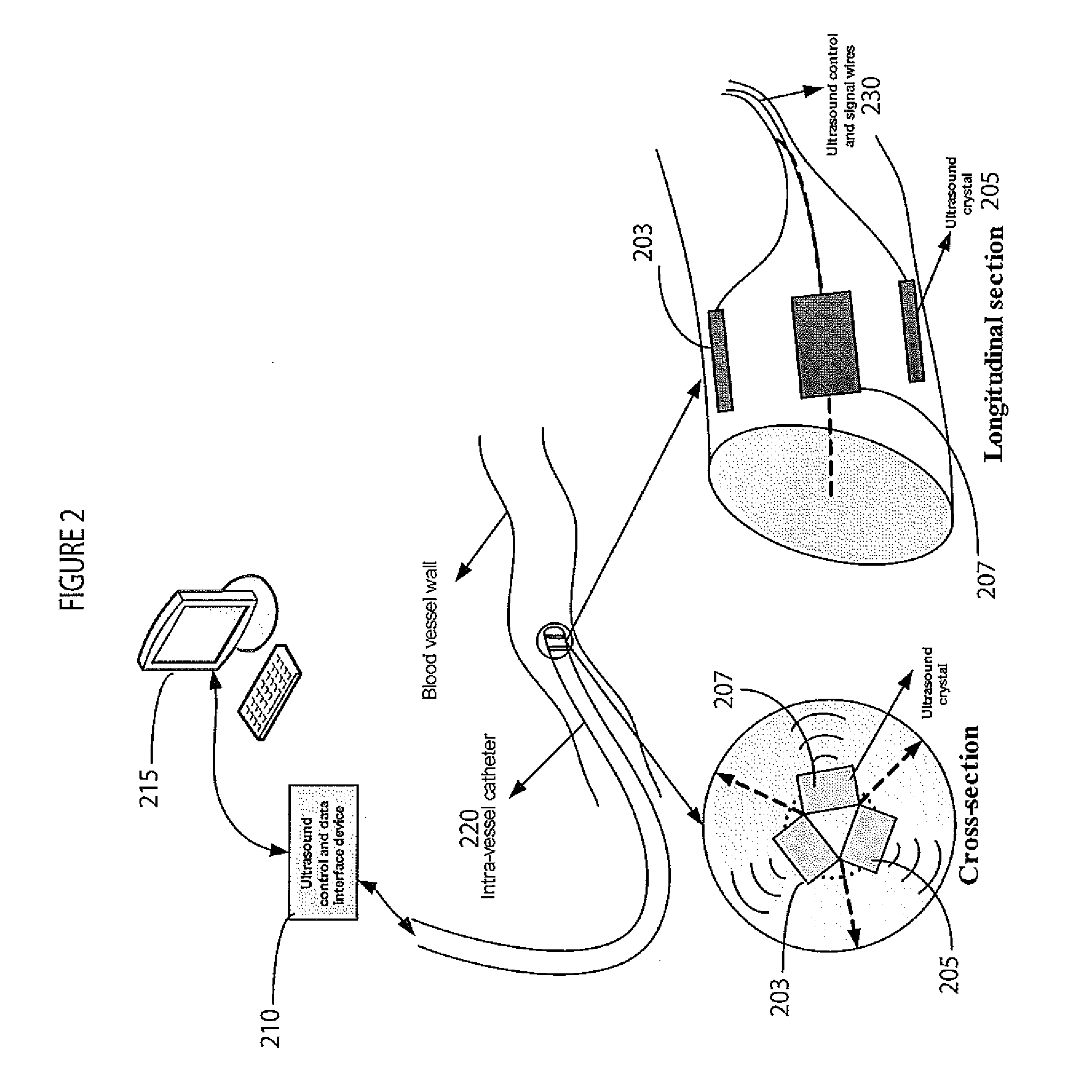 System for Cardiac Condition Detection and Characterization