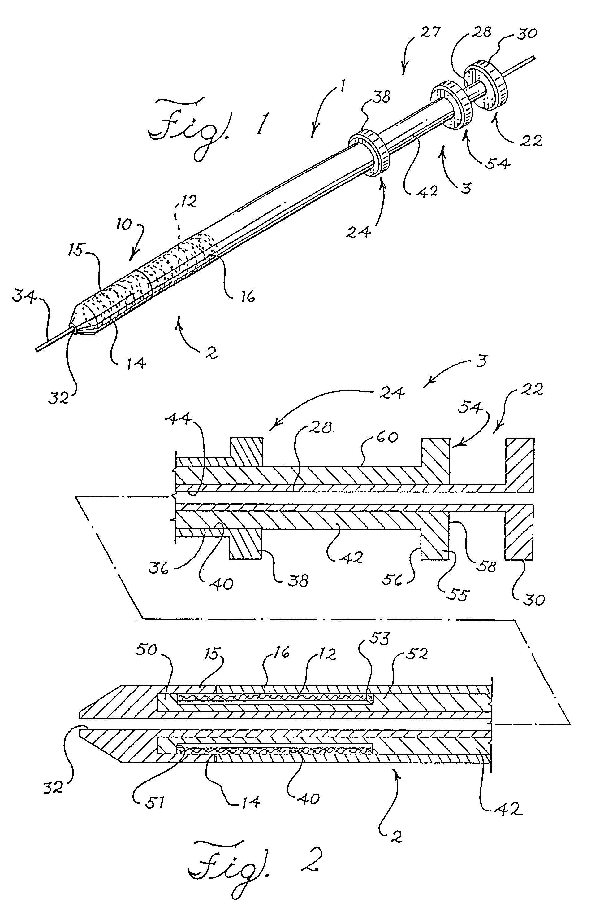 Split sheath deployment system