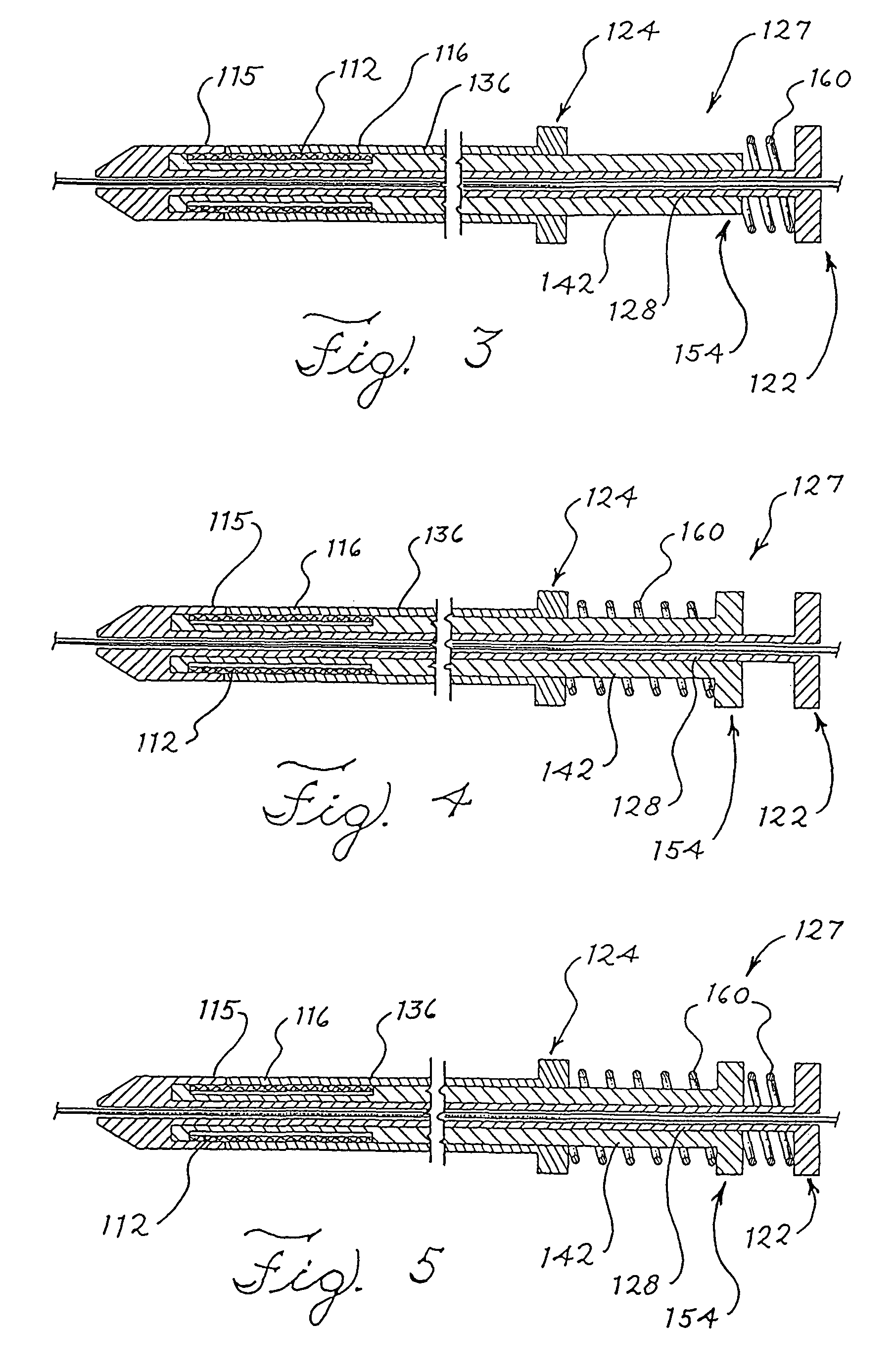 Split sheath deployment system