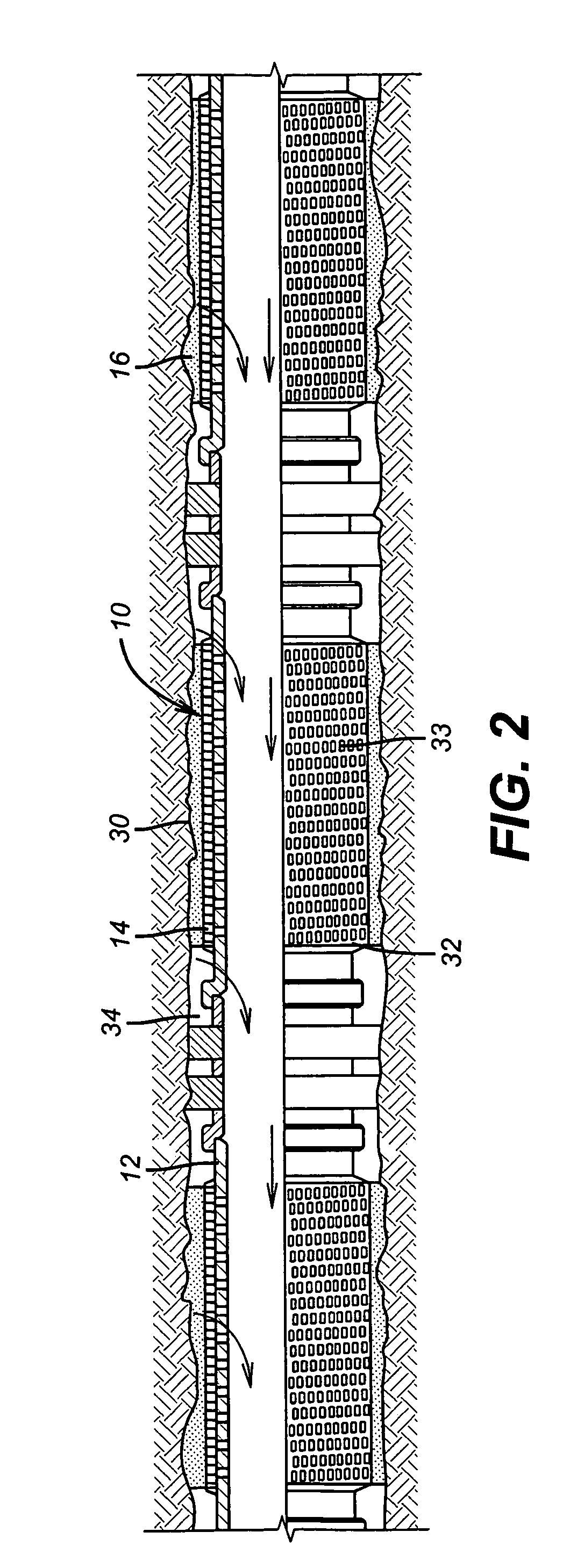 Self-conforming screen