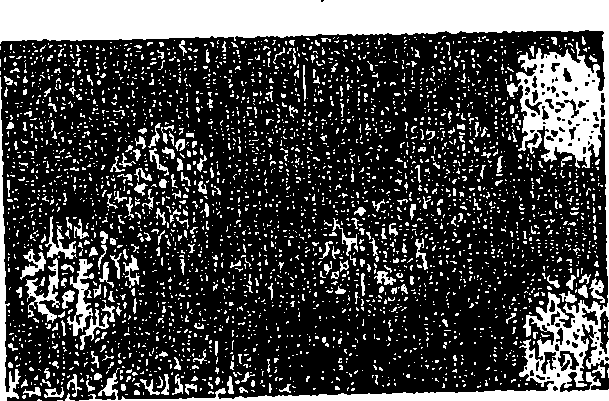 Seneca valley virus based compositions and methods for treating disease