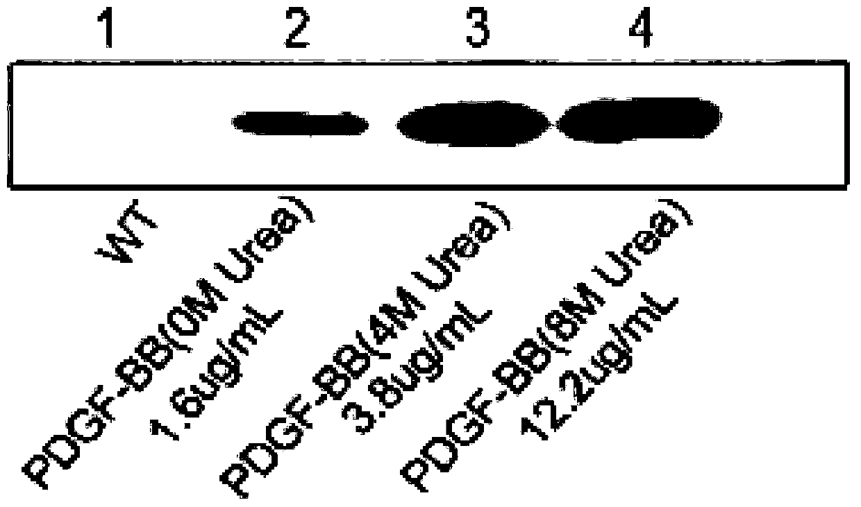 Protein sericin gel based on transformation of human platelet derived growth factor gene silk and preparation method and application of protein sericin gel