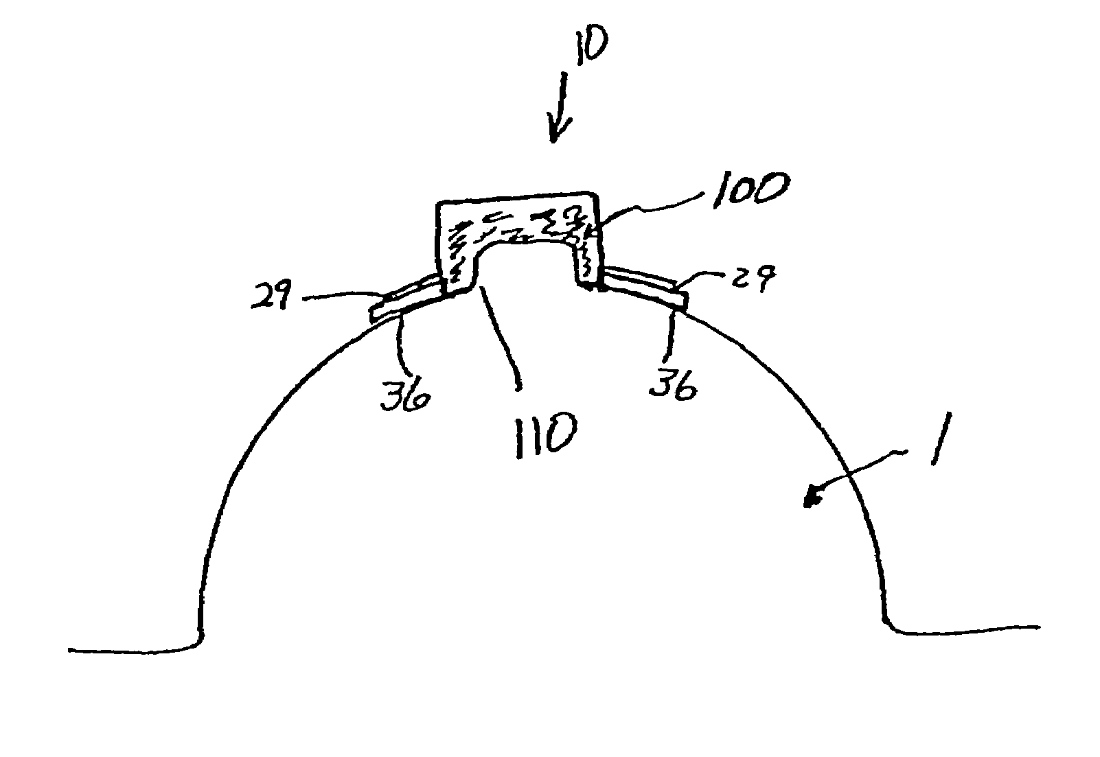 Cover and applicator for a portion of a mammalian body