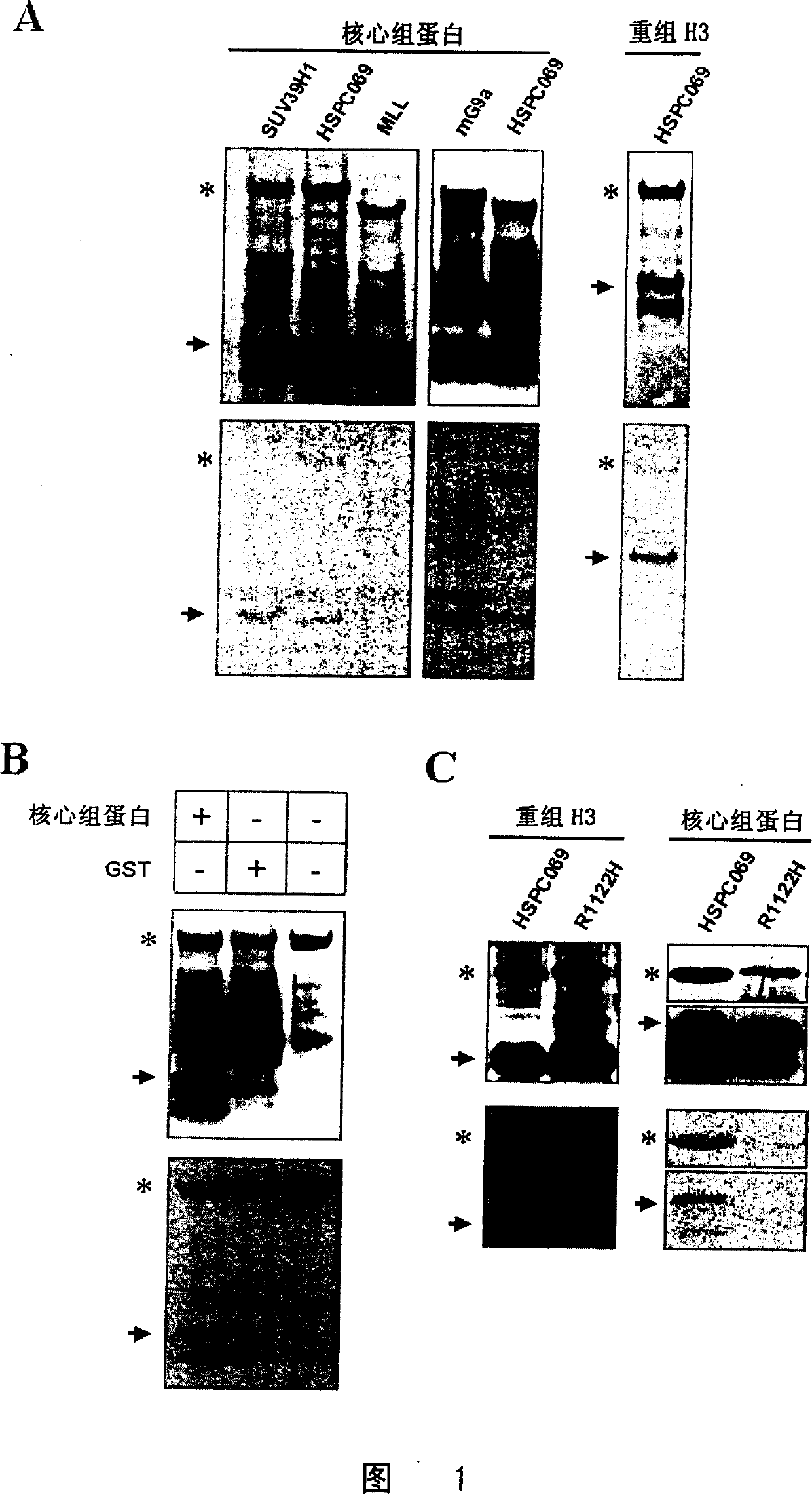 Histone methyl transferase and its preparing method