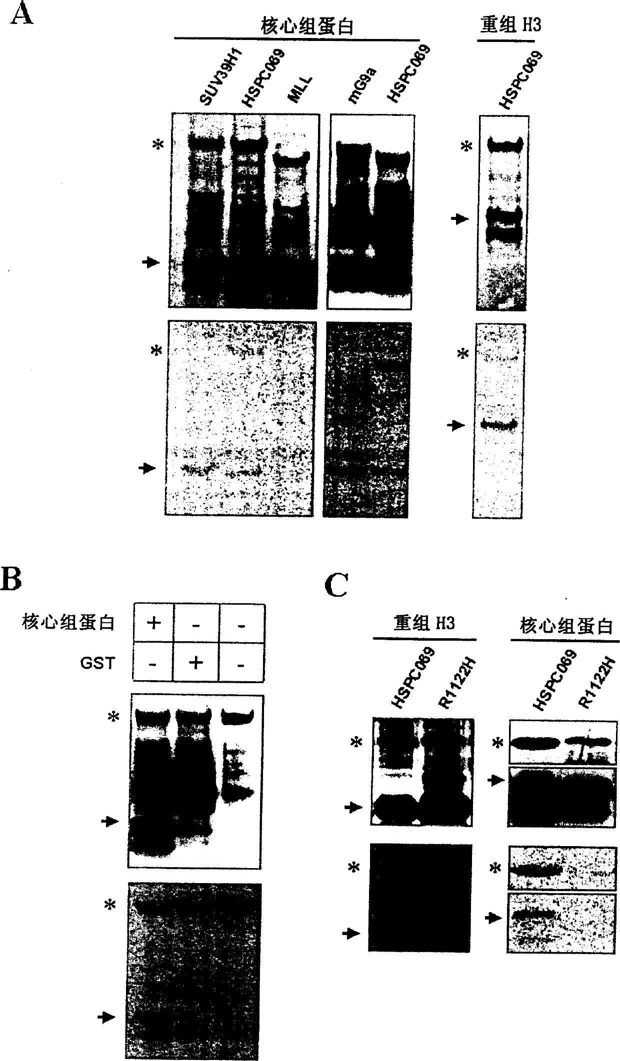 Histone methyl transferase and its preparing method