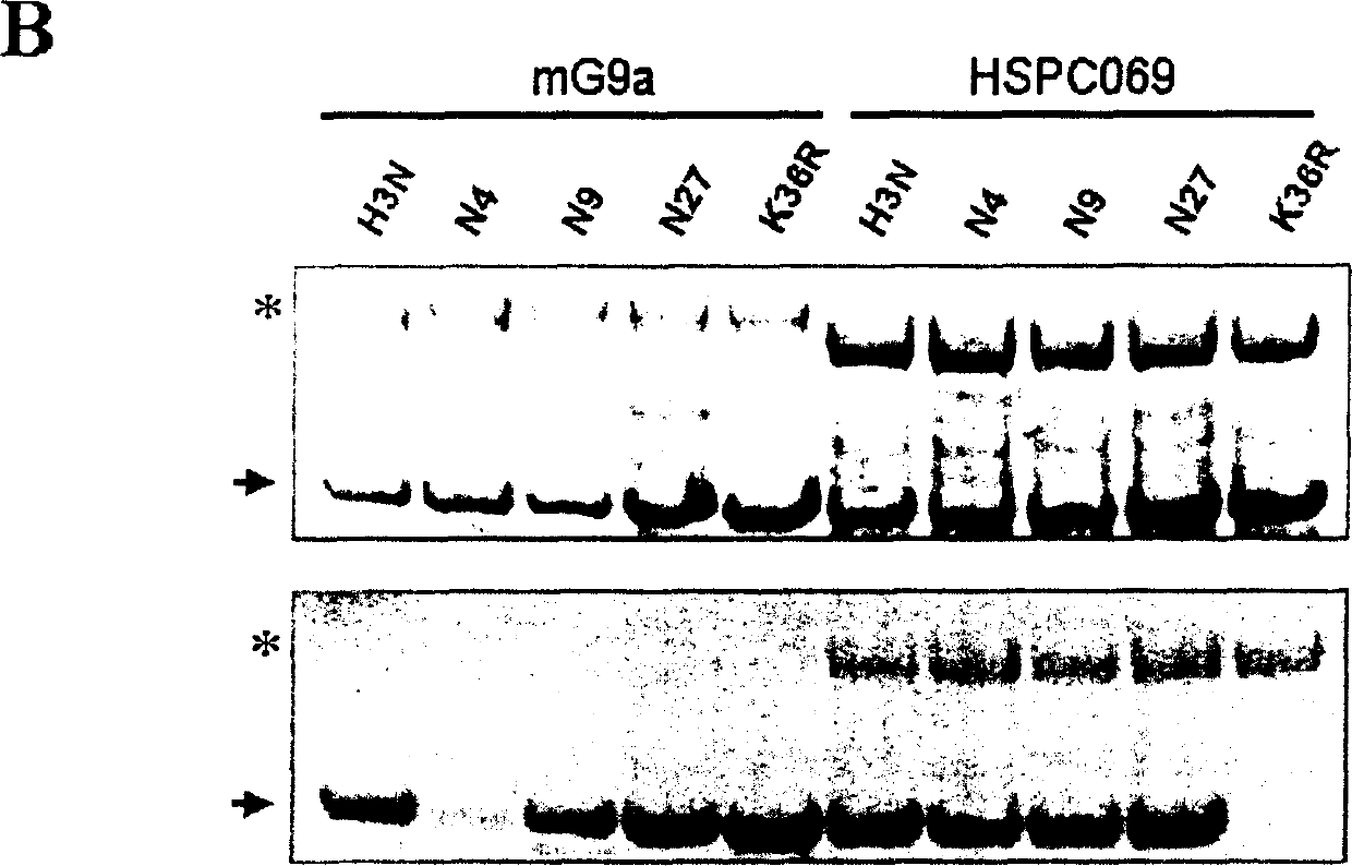 Histone methyl transferase and its preparing method