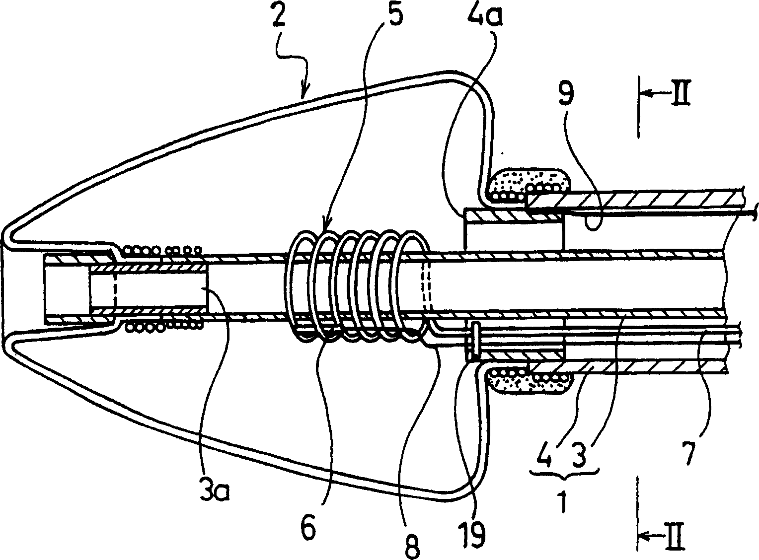 Catheter for treating irregular heart pulse