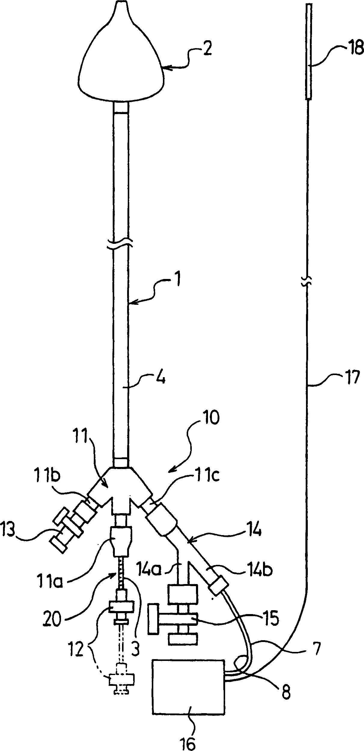 Catheter for treating irregular heart pulse